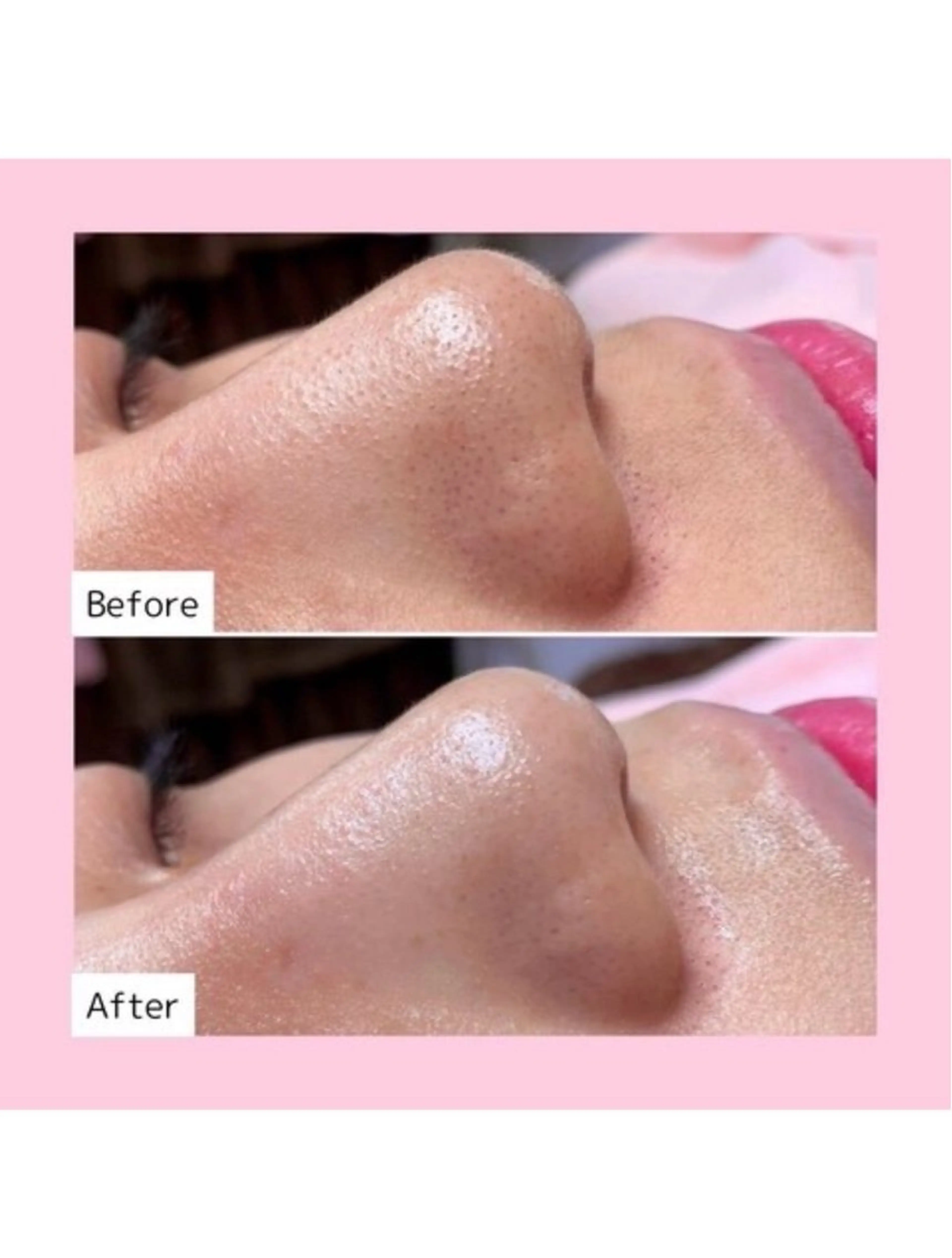 【白玉艶肌パック仕上げ】🥚（美白）１回の写真