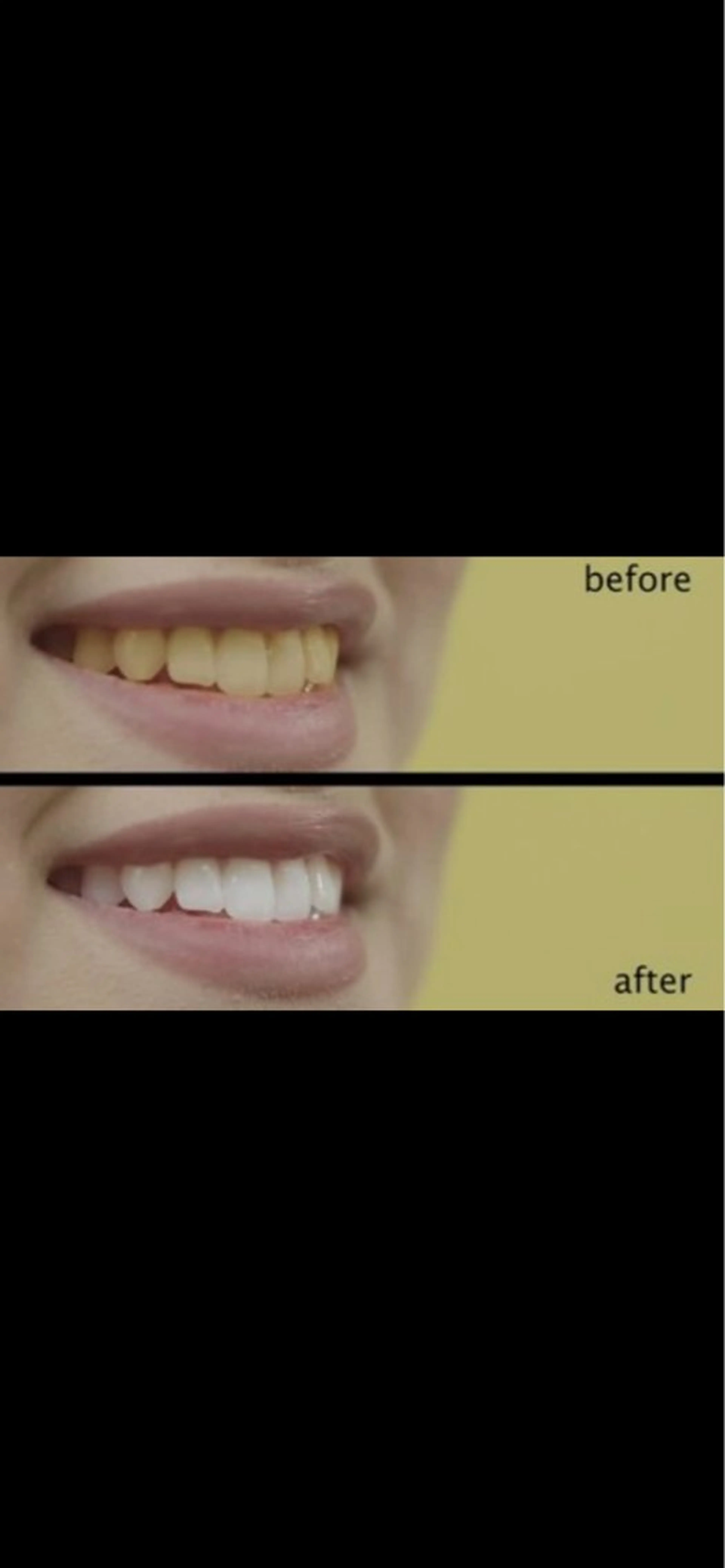 WHITENING ハウスのマツエク・マツパデザイン