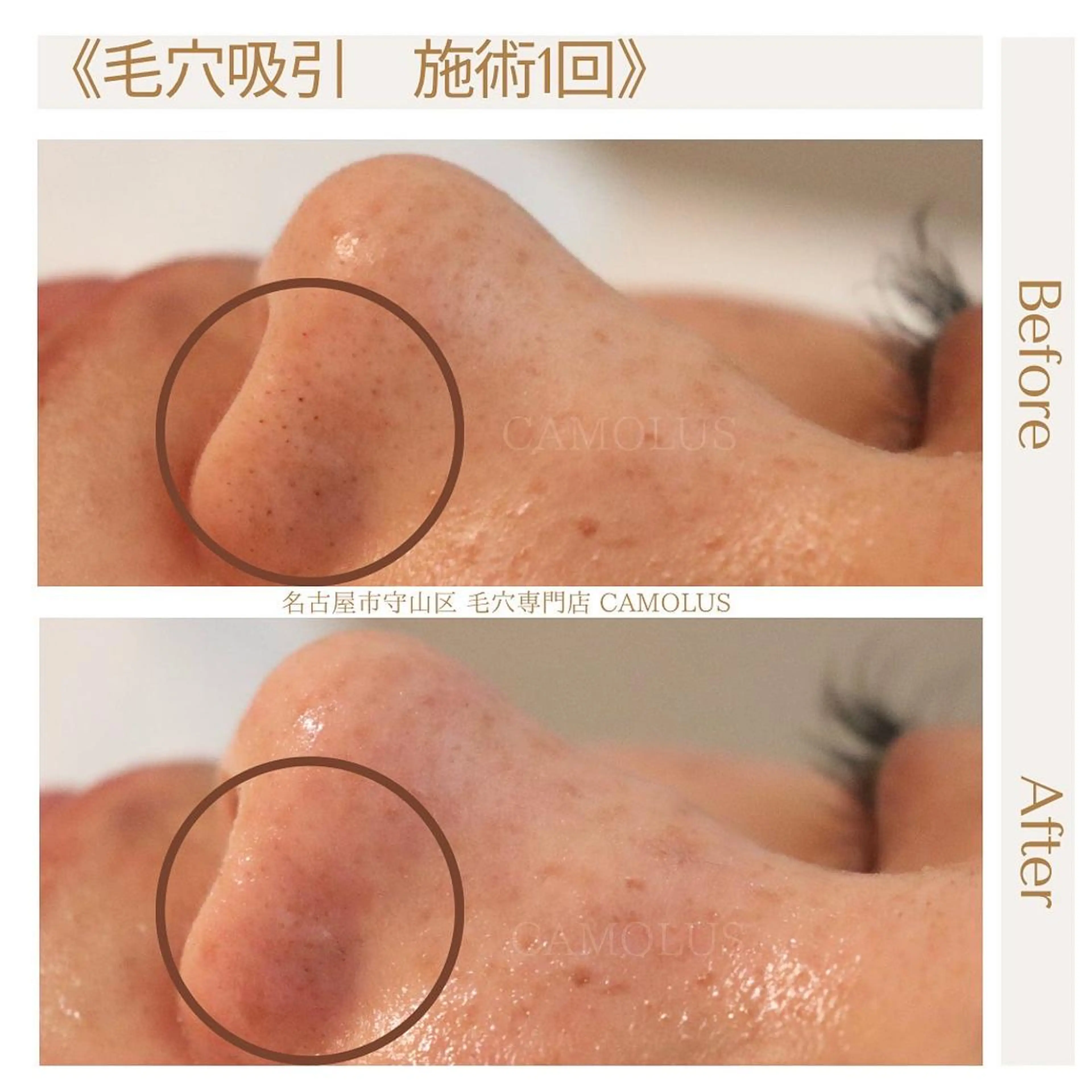 SUZUKI SHURIのエステ・リラクイメージ