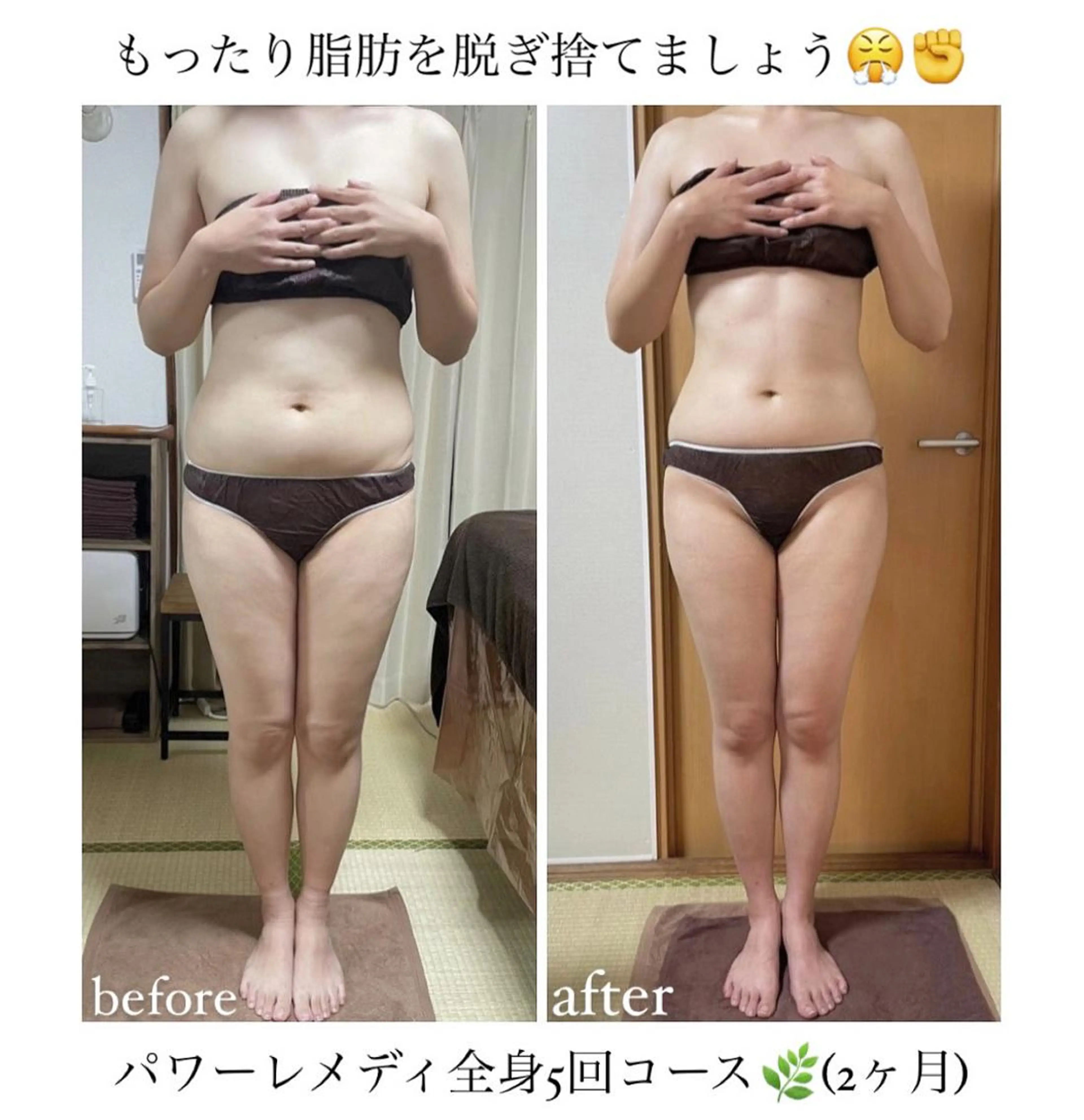 《本気痩せ×疲労改善 》  BILOOPのエステ・リラクイメージ