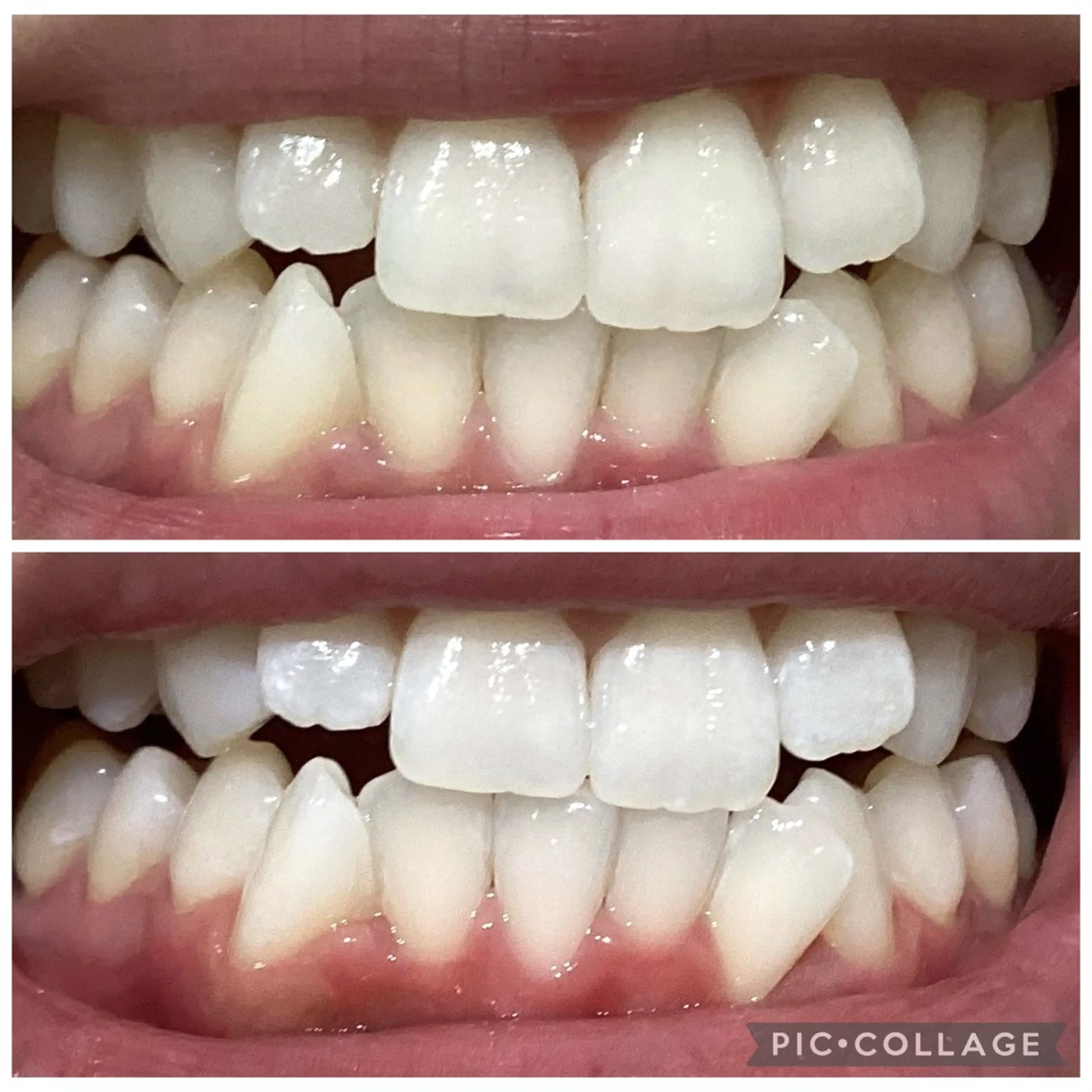 セルフホワイトニングサロン　Betee所属・セルフホワイトニング Beteeのエステ・リラクイメージ