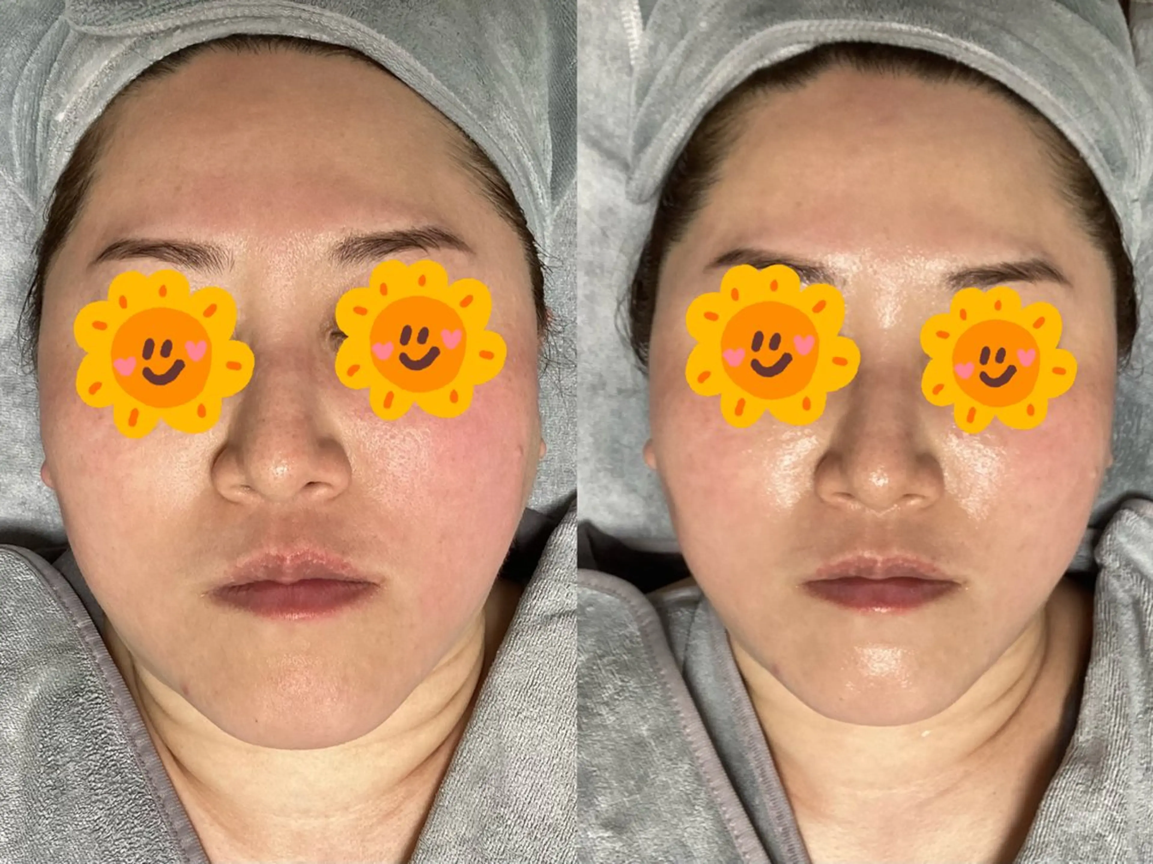 エステ リラク ホワイティアビシェル ウラワ　白澤奇のエステ・リラクイメージ