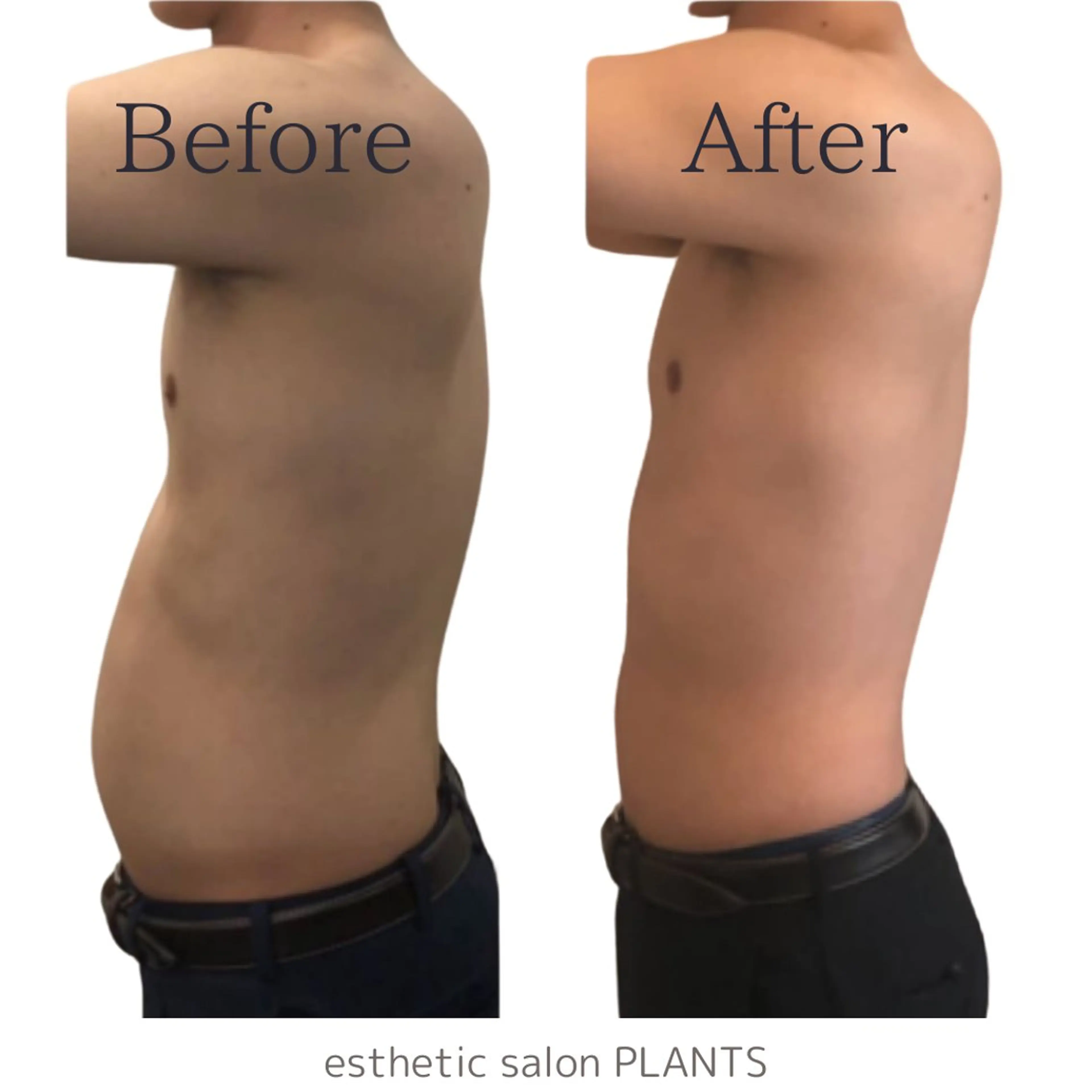 エステ エステティックサロン PLANTSのエステ・リラクイメージ