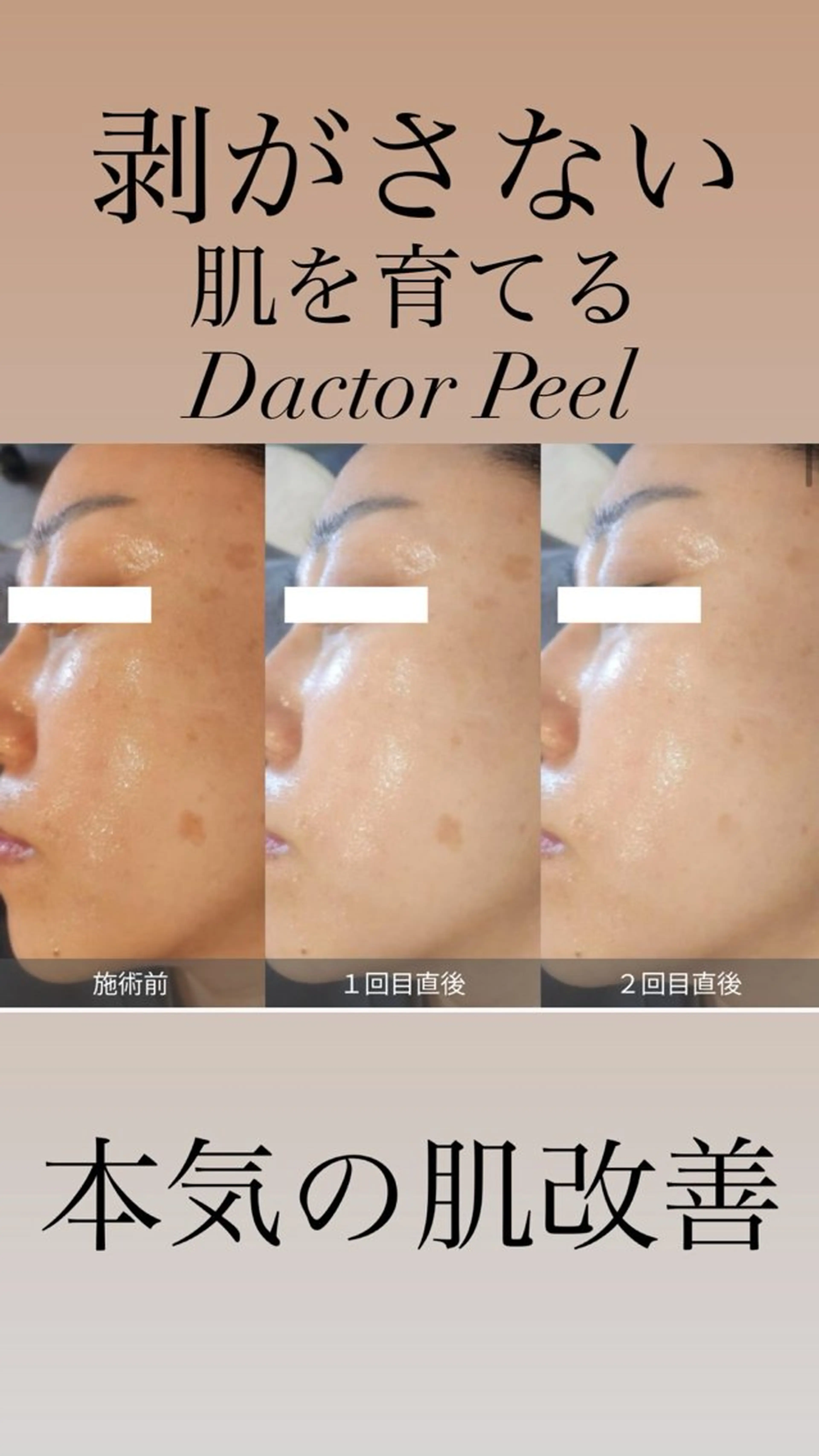 エステ GrandAzure 大人の肌改善のエステ・リラクイメージ