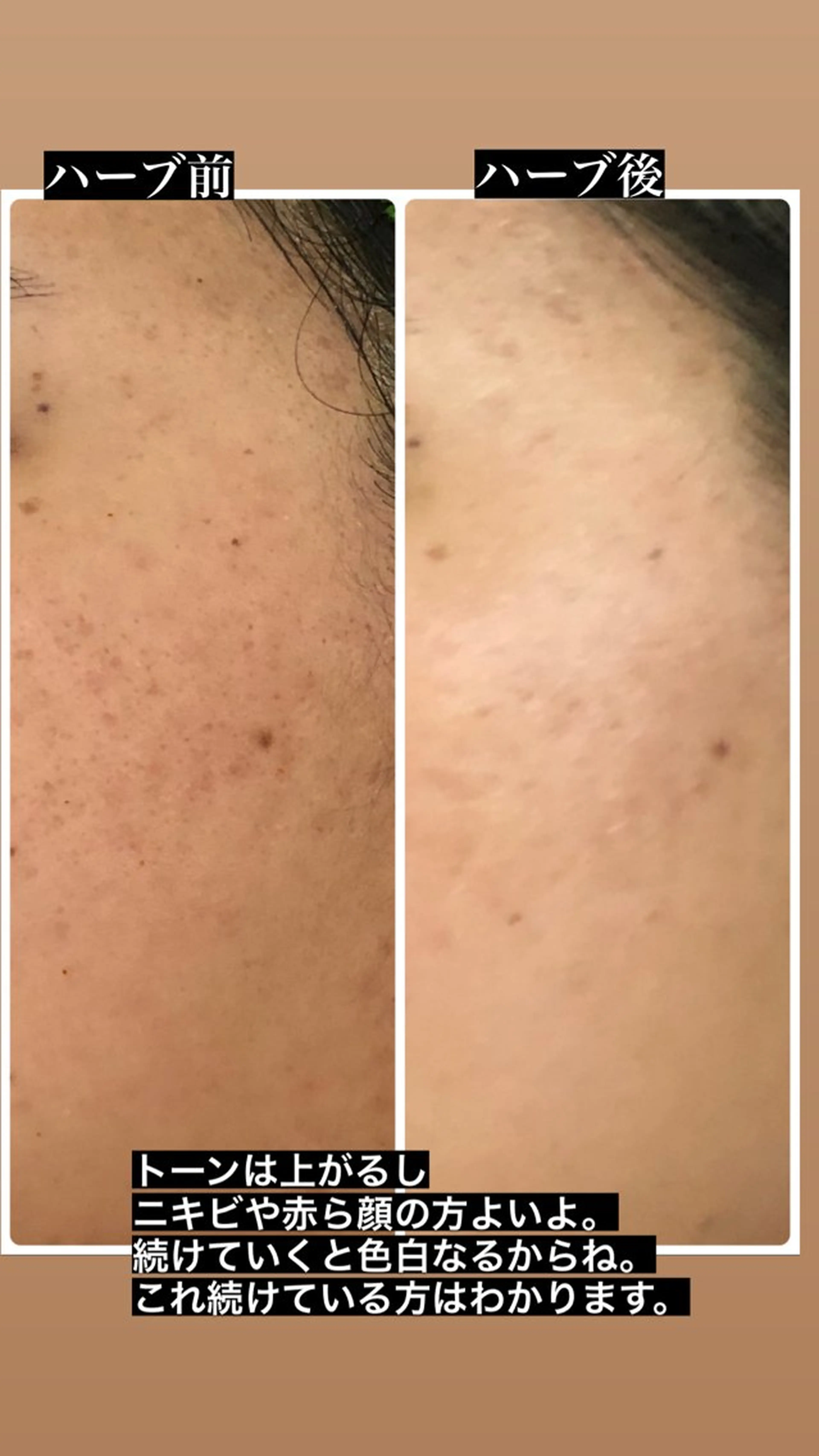 宜野湾美肌脱毛fuu okinawaタイラのエステ・リラクイメージ