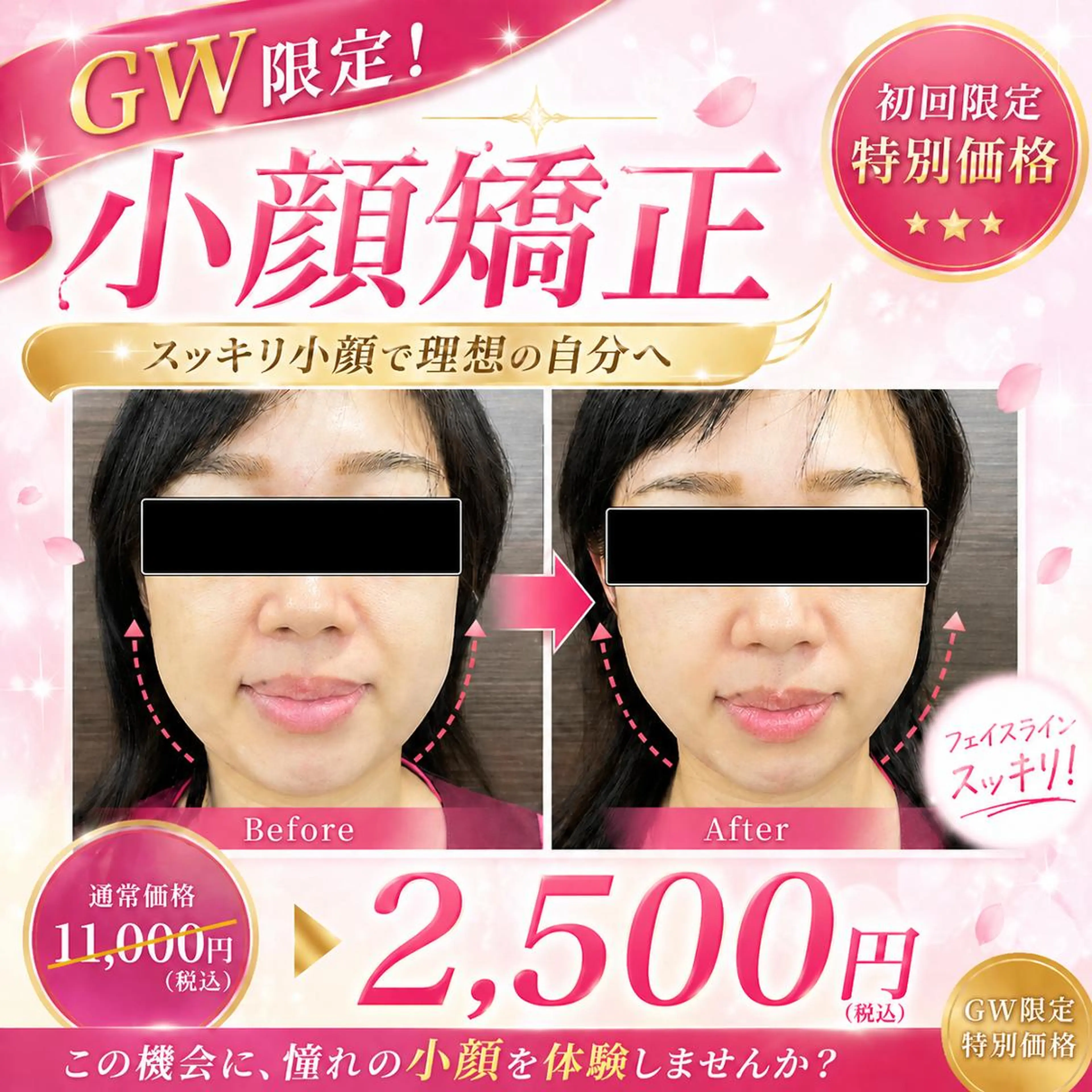 エステ リラク 【美容鍼・小顔鍼】 鍼灸師　森原拓磨のエステ・リラクイメージ