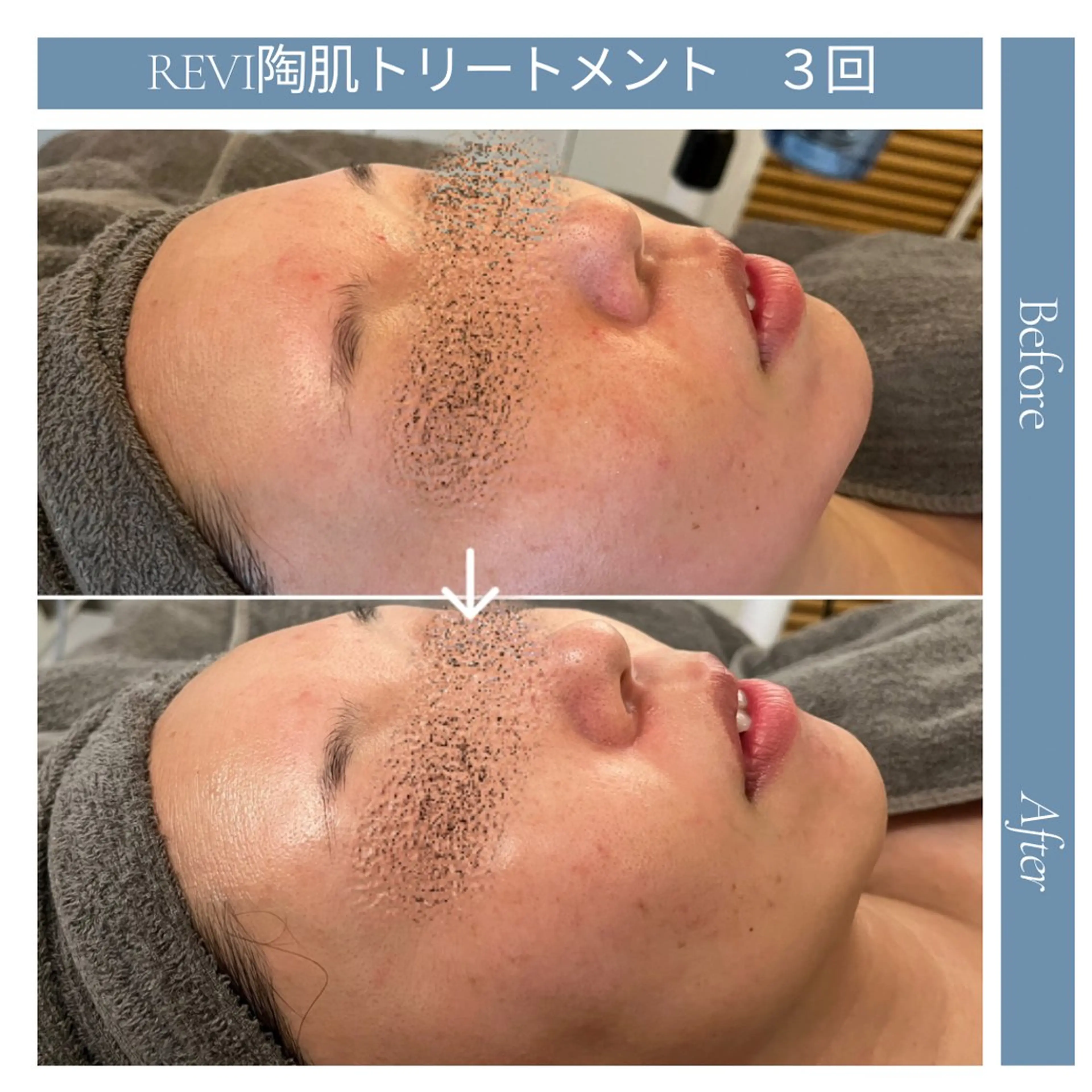 Blue Moon 【ブルームーン】のエステ・リラクイメージ