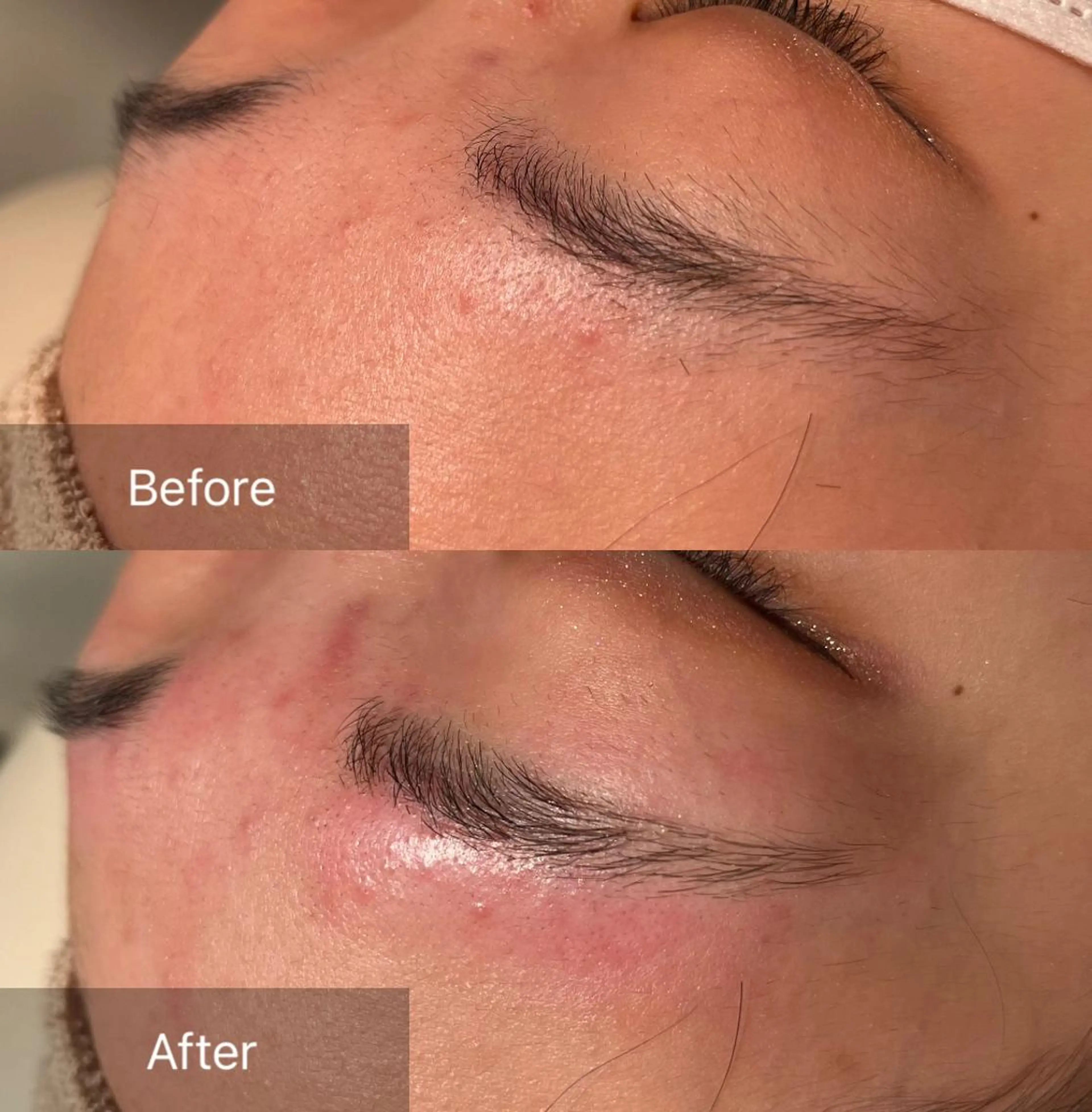 アイブロウ 眉毛ワックス脱毛 for woman所属・森 美優のエステ・リラクイメージ