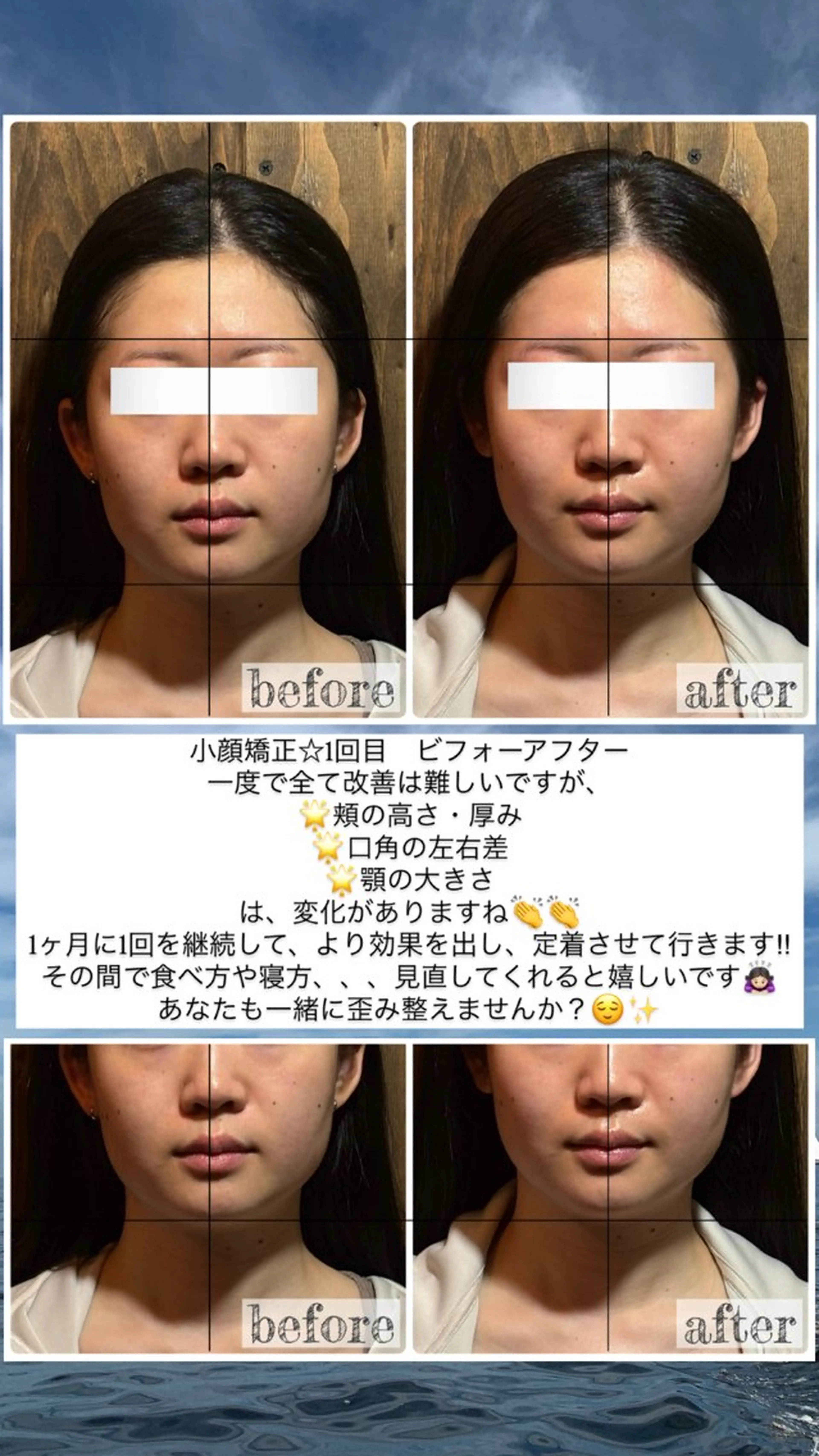 エステ リラク 💎後悔させない小顔 矯正💎イトヤマ🌱のエステ・リラクイメージ