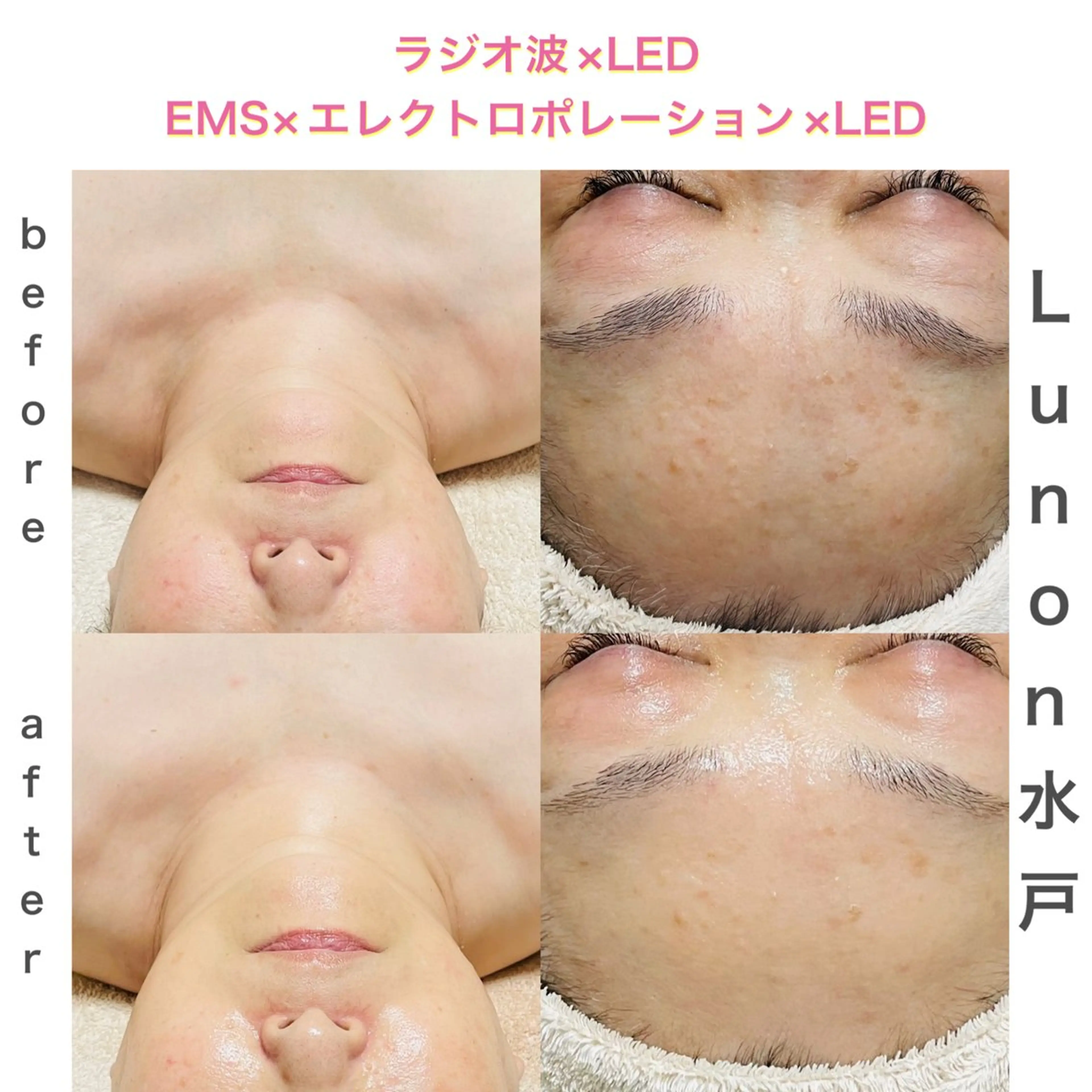 Lunon 【ルノン】のエステ・リラクイメージ