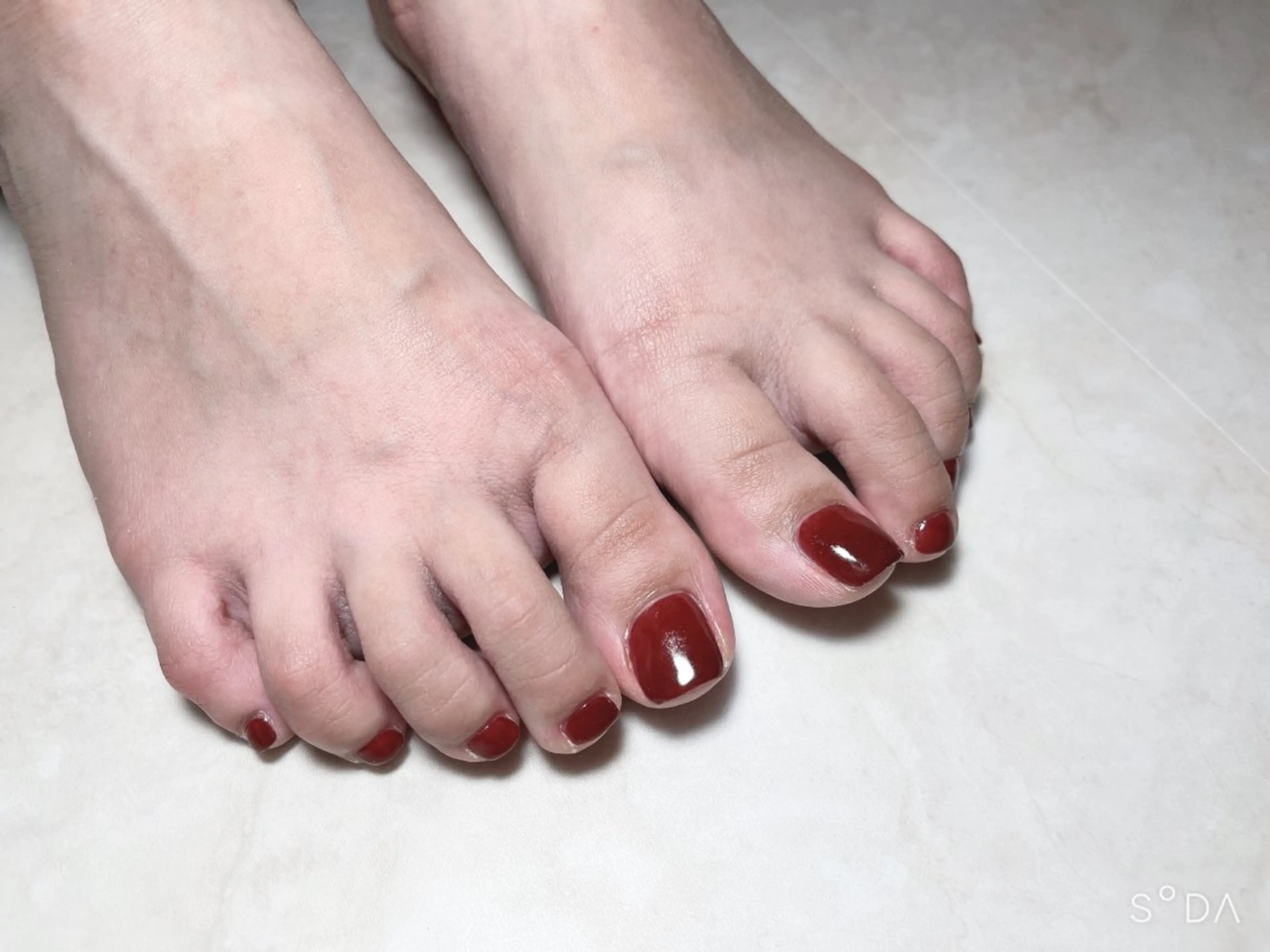 ネイル フットネイル ネイル脱毛 Reeのネイルデザイン