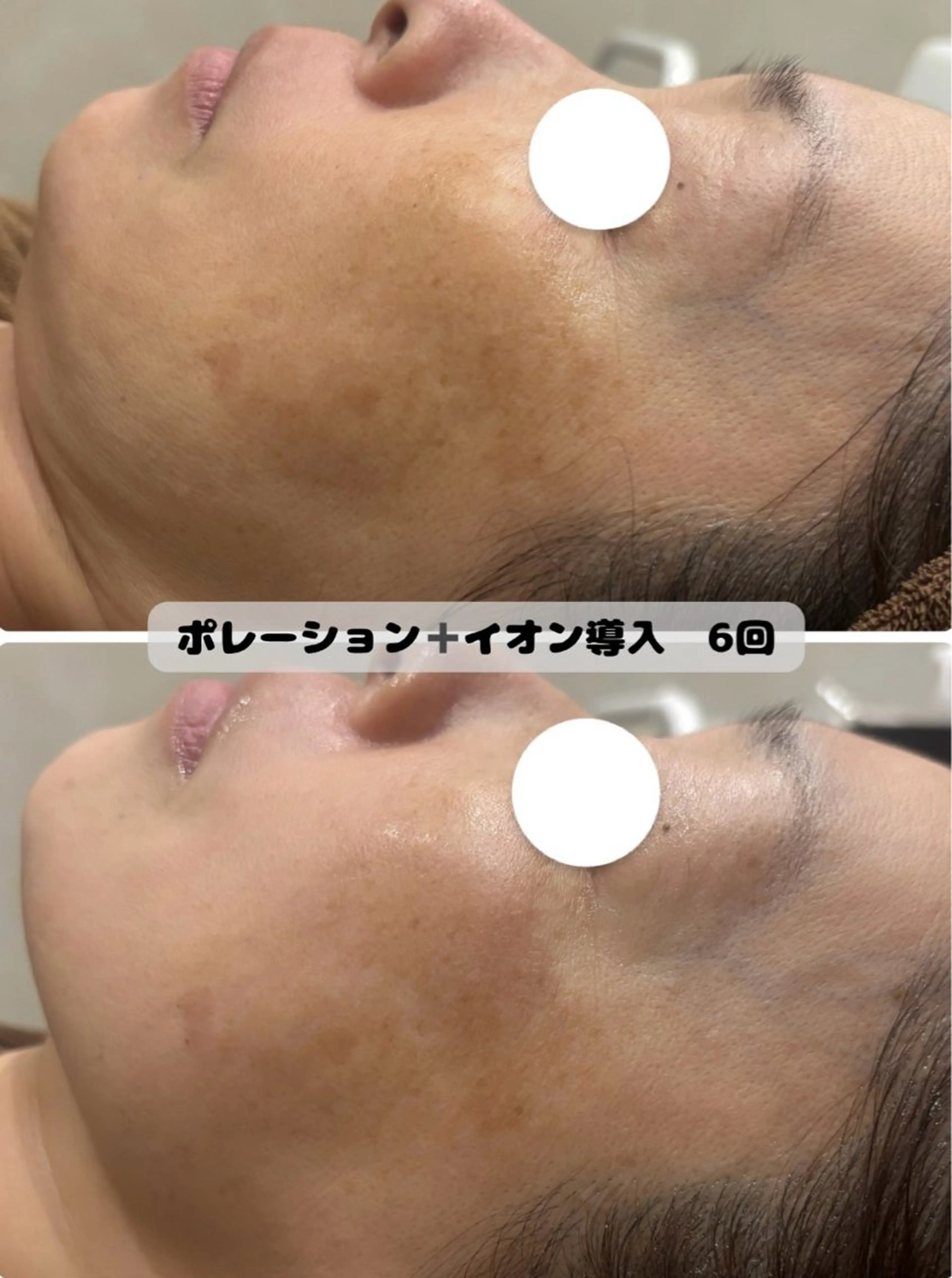 菊地 そらのエステ・リラクイメージ