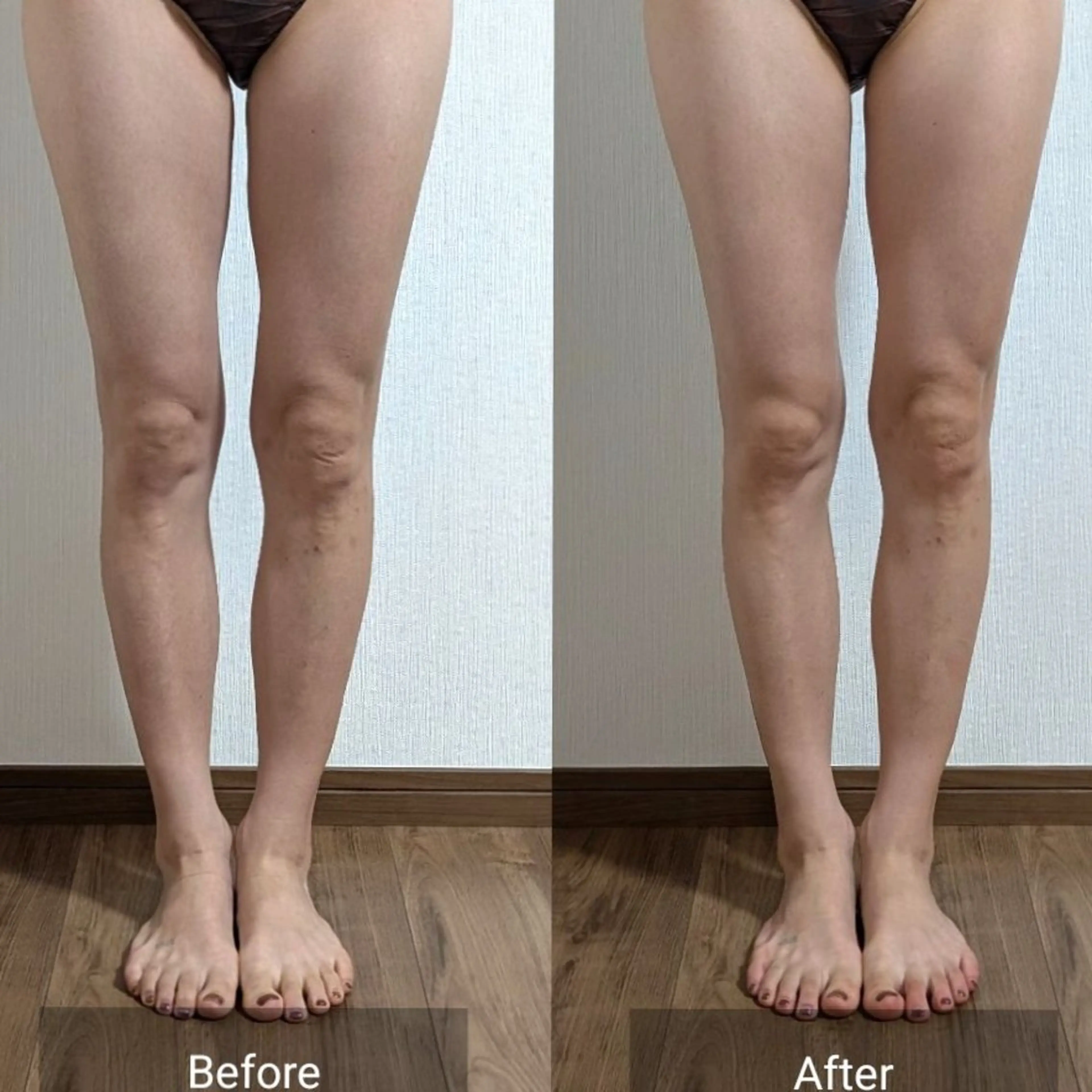 エステ nail RiRi アトレナチュラのエステ・リラクイメージ