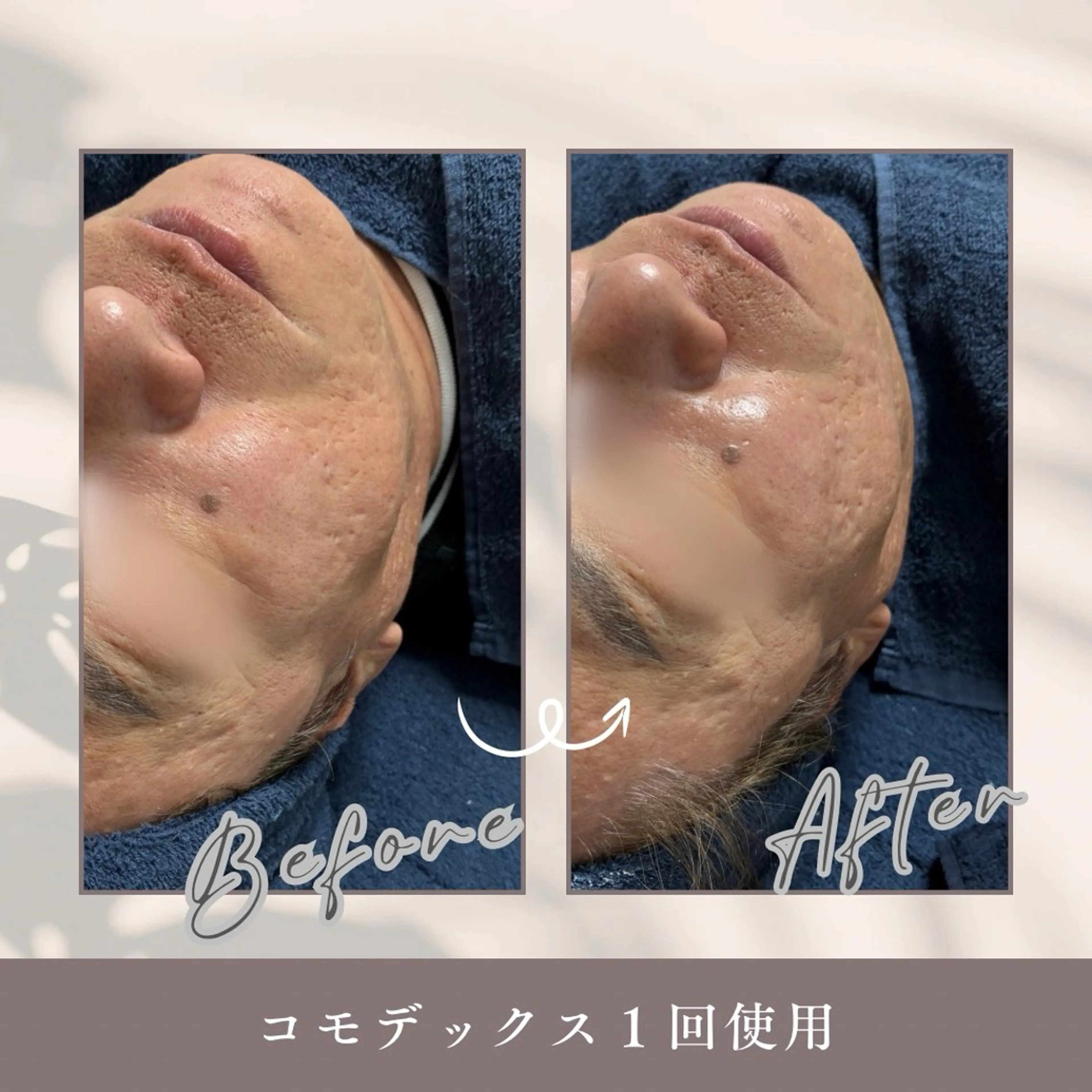 エステ Amor 渡邉のエステ・リラクイメージ