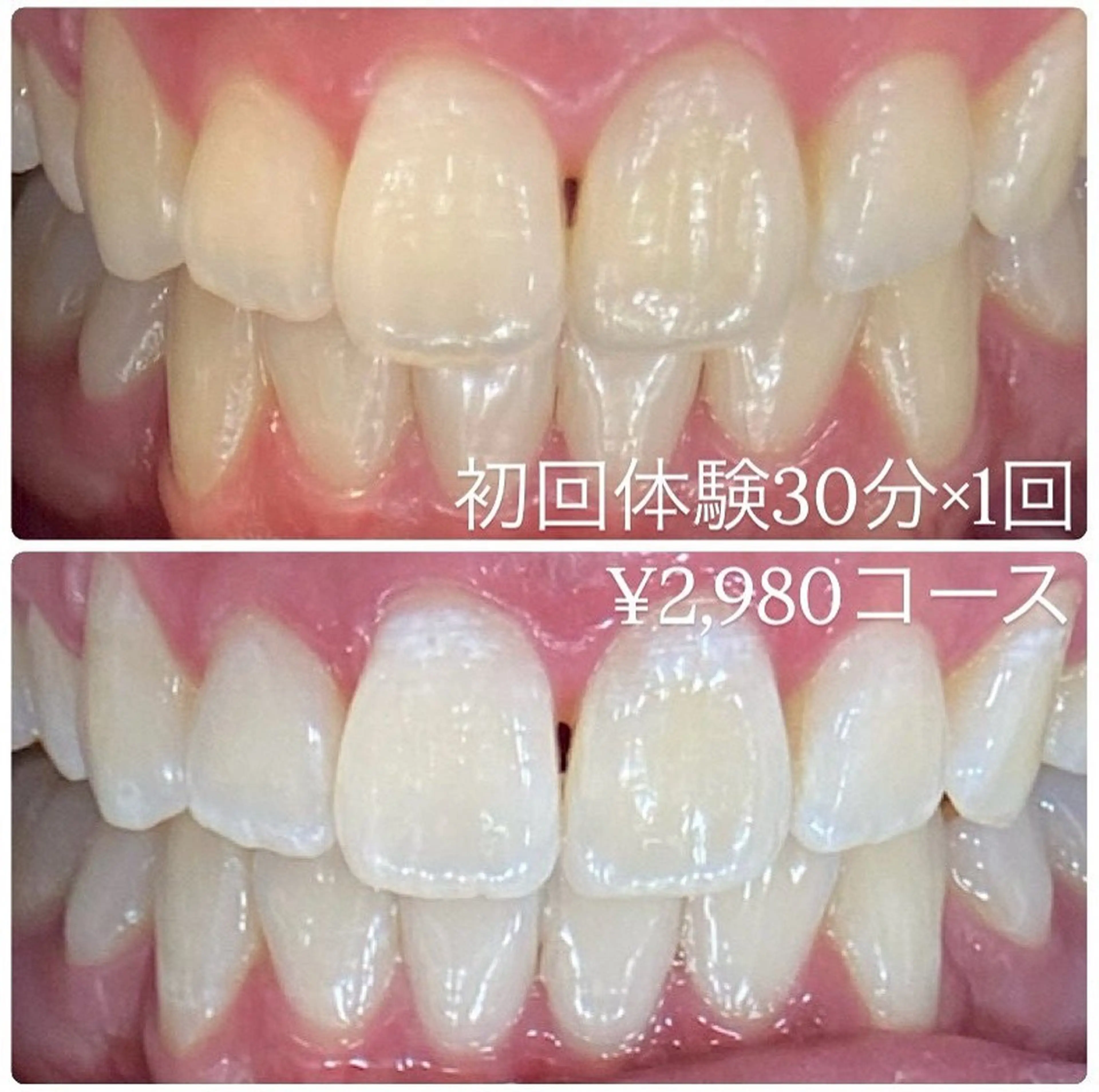 その他 ホワイトニングルーム 横浜店のその他イメージ