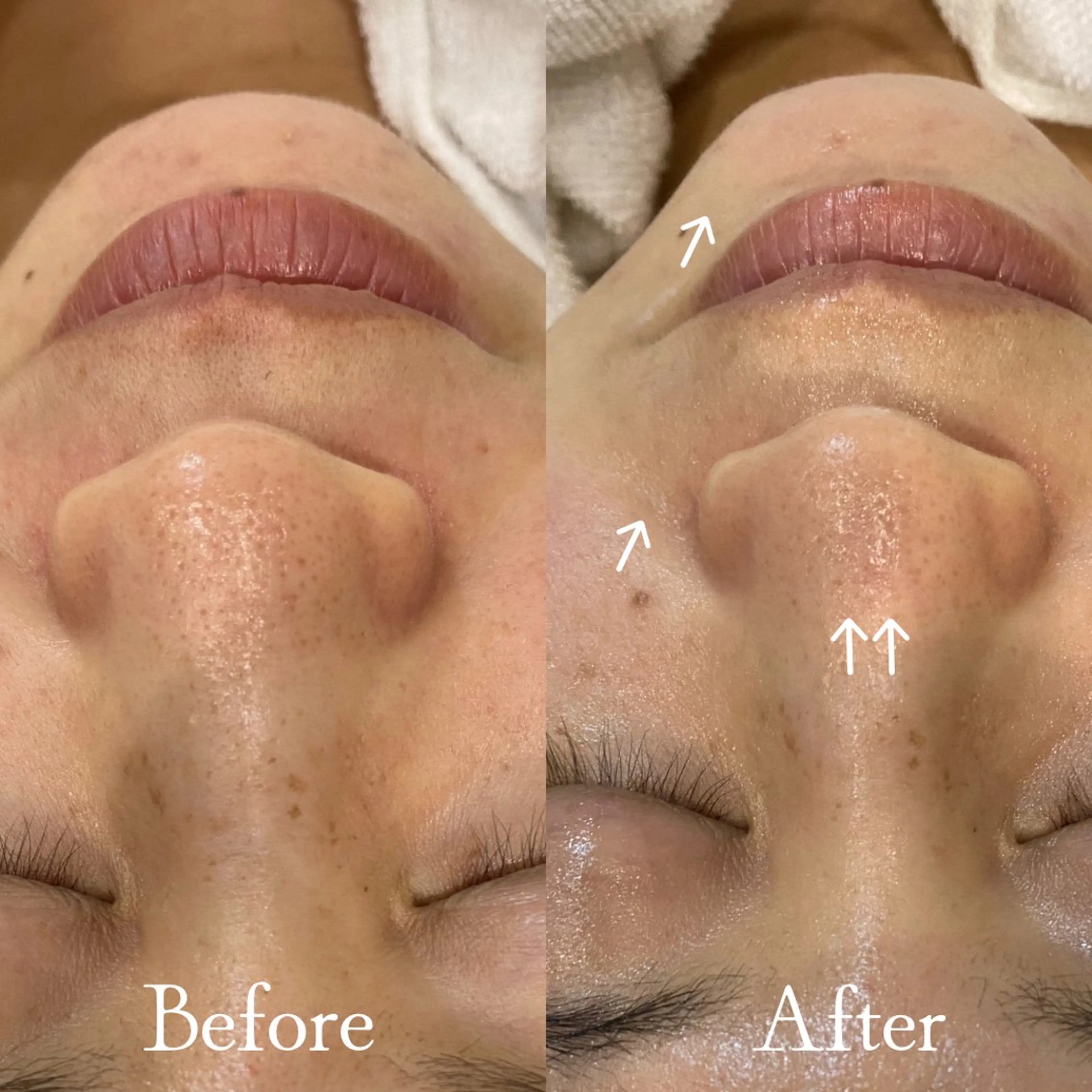 エステ Del'm豊橋所属・豊橋De'Im 安部のエステ・リラクイメージ