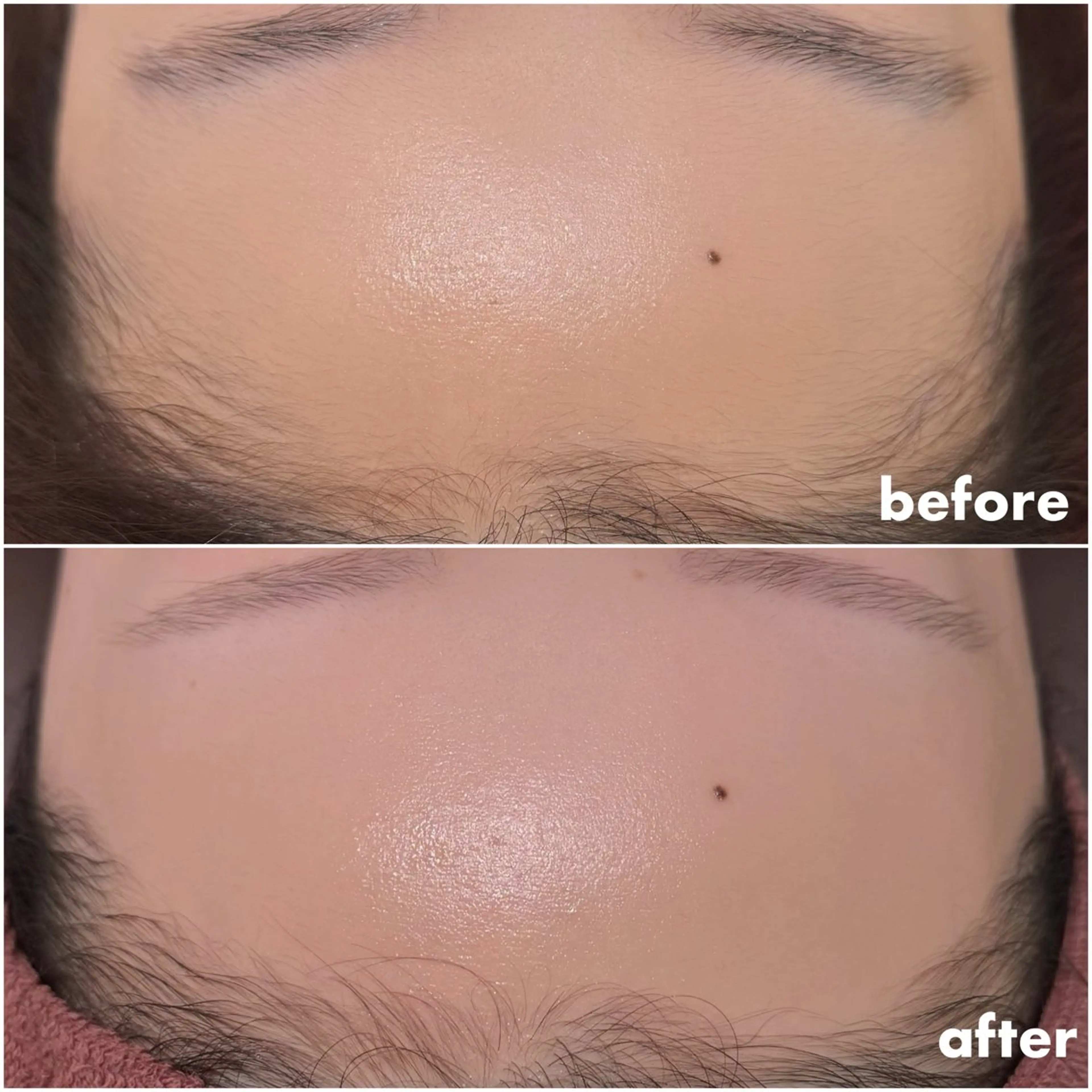 REVE （レーヴ）のマツエク・マツパデザイン