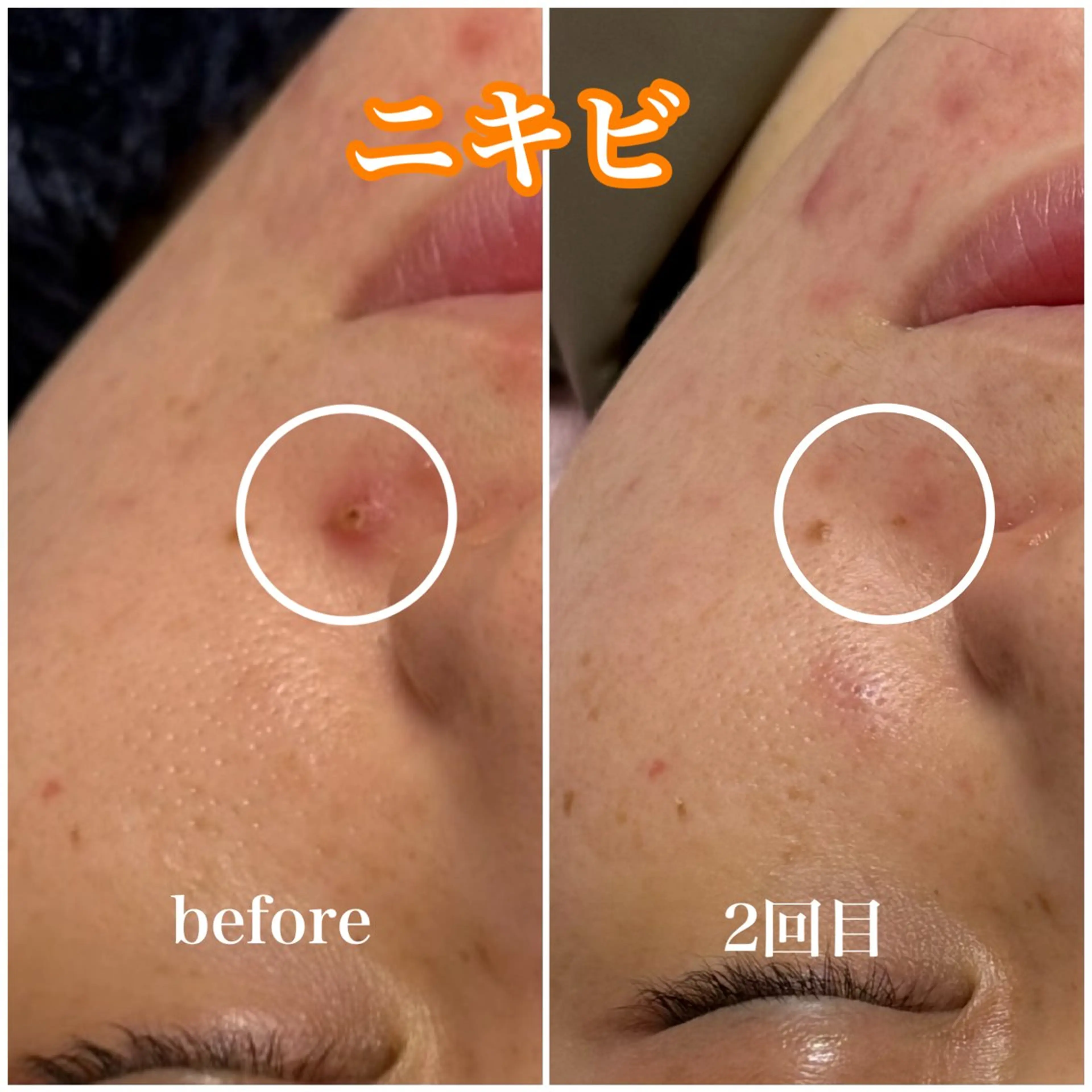 毛穴レス ハーブ＆ ワックス脱毛×光脱毛のエステ・リラクイメージ