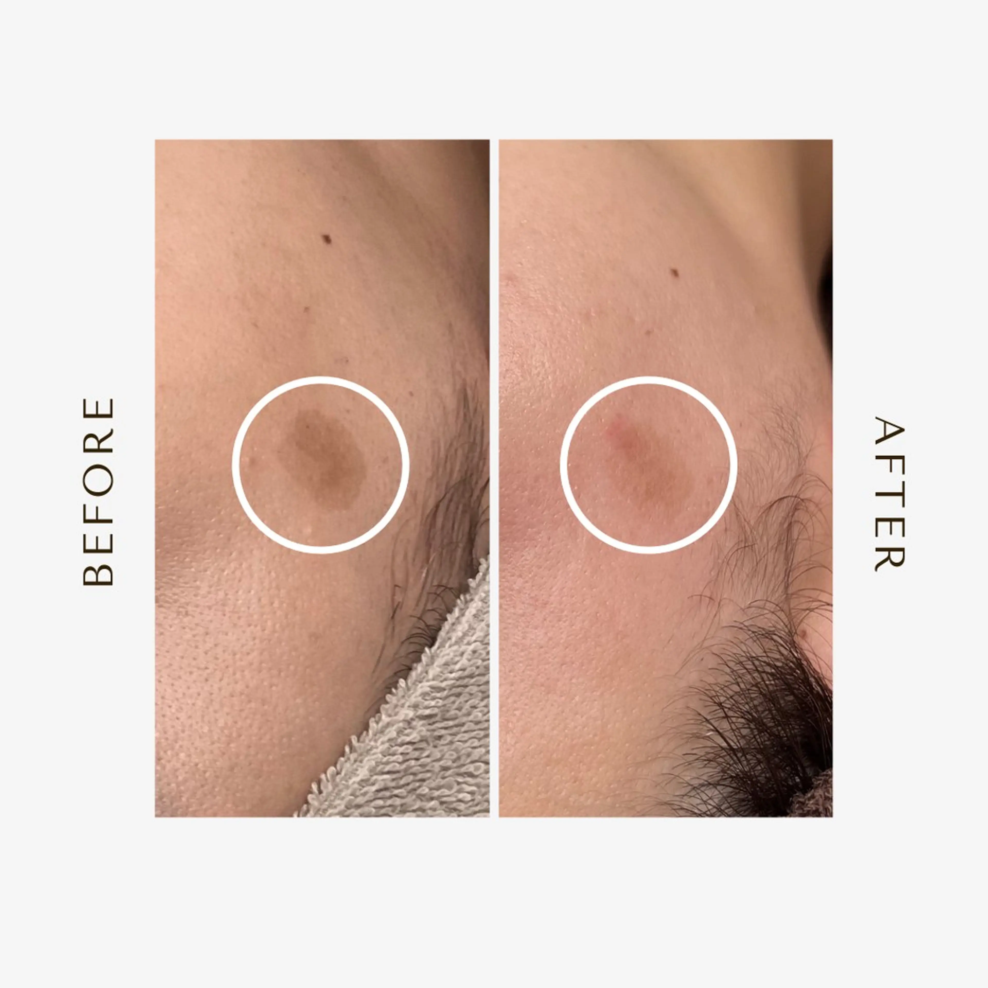 エステ 1st｜フェイシャル エステ専門店のエステ・リラクイメージ