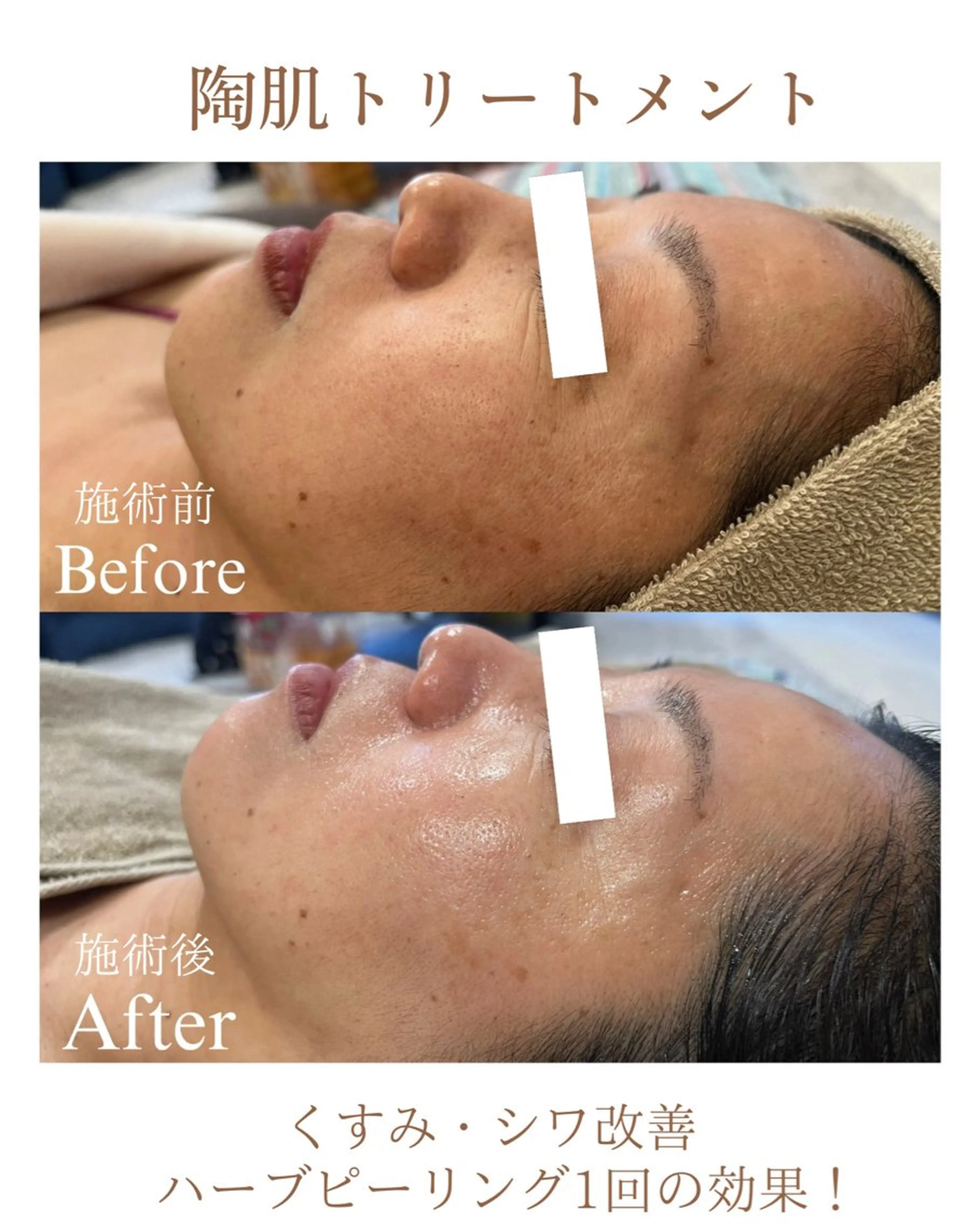 エステ 肌質改善専門サロン Lusisのエステ・リラクイメージ