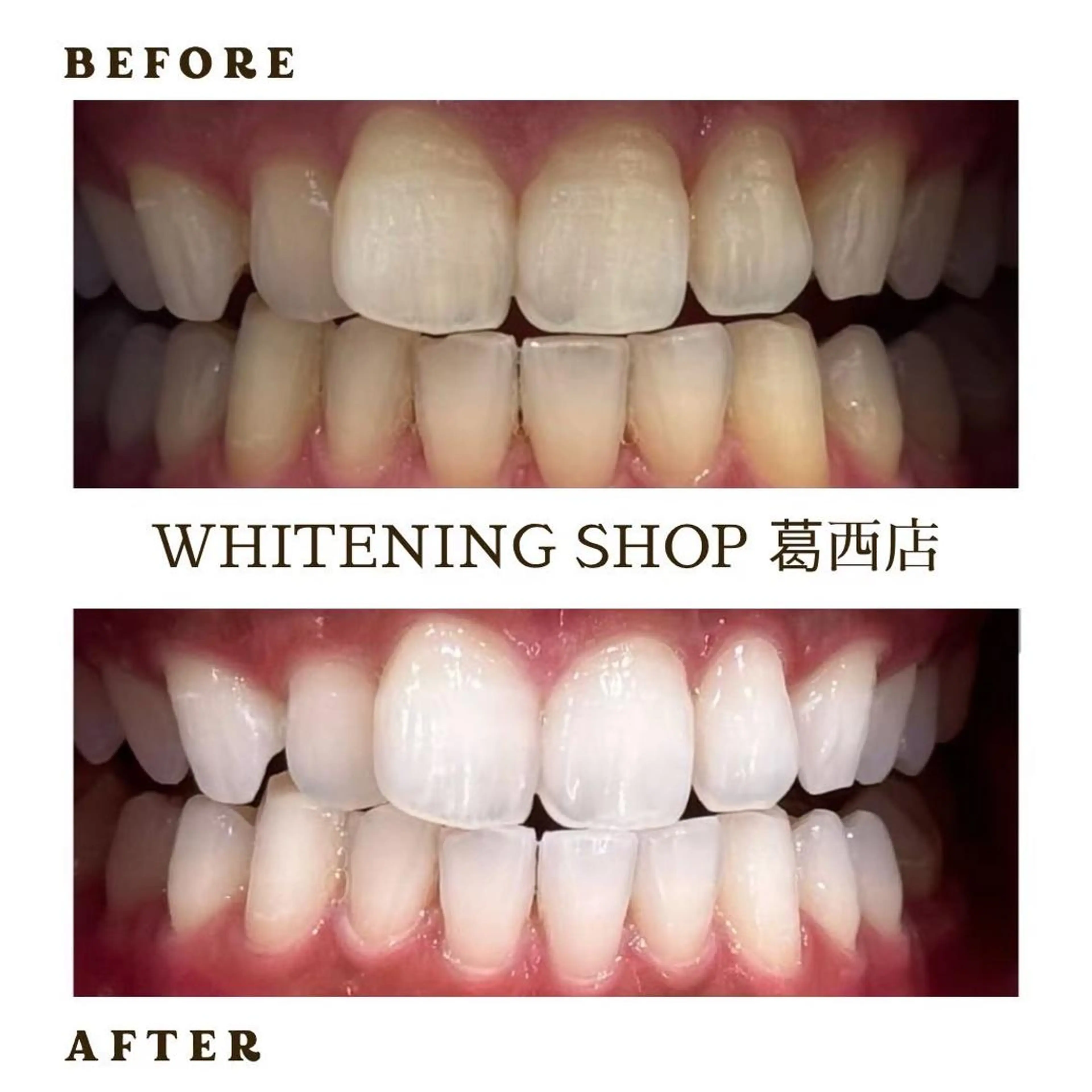 メンズ その他 ホワイトニング ショップ葛西店のその他イメージ