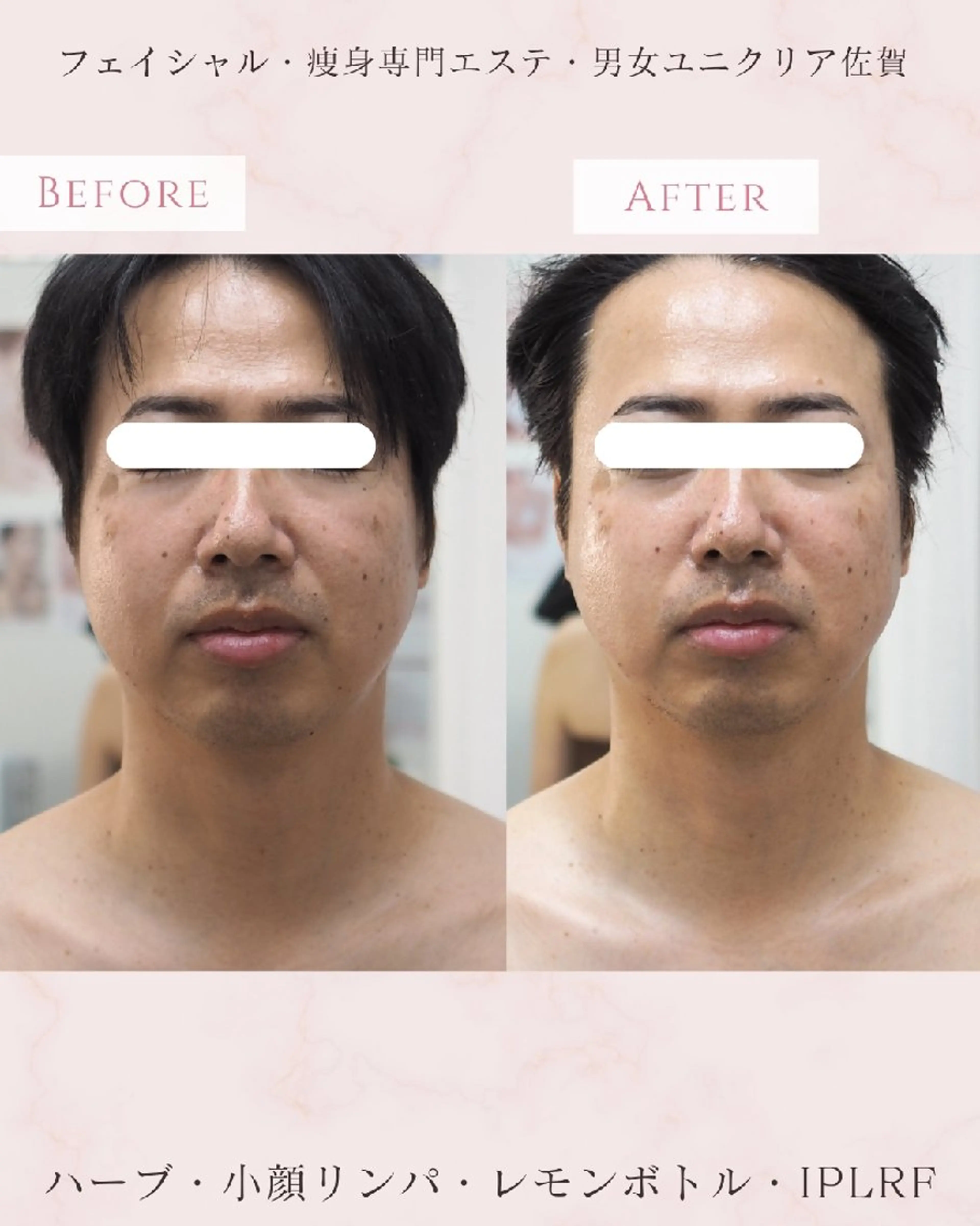 メンズ 佐賀 痩身・美肌 @uni.clearのエステ・リラクイメージ