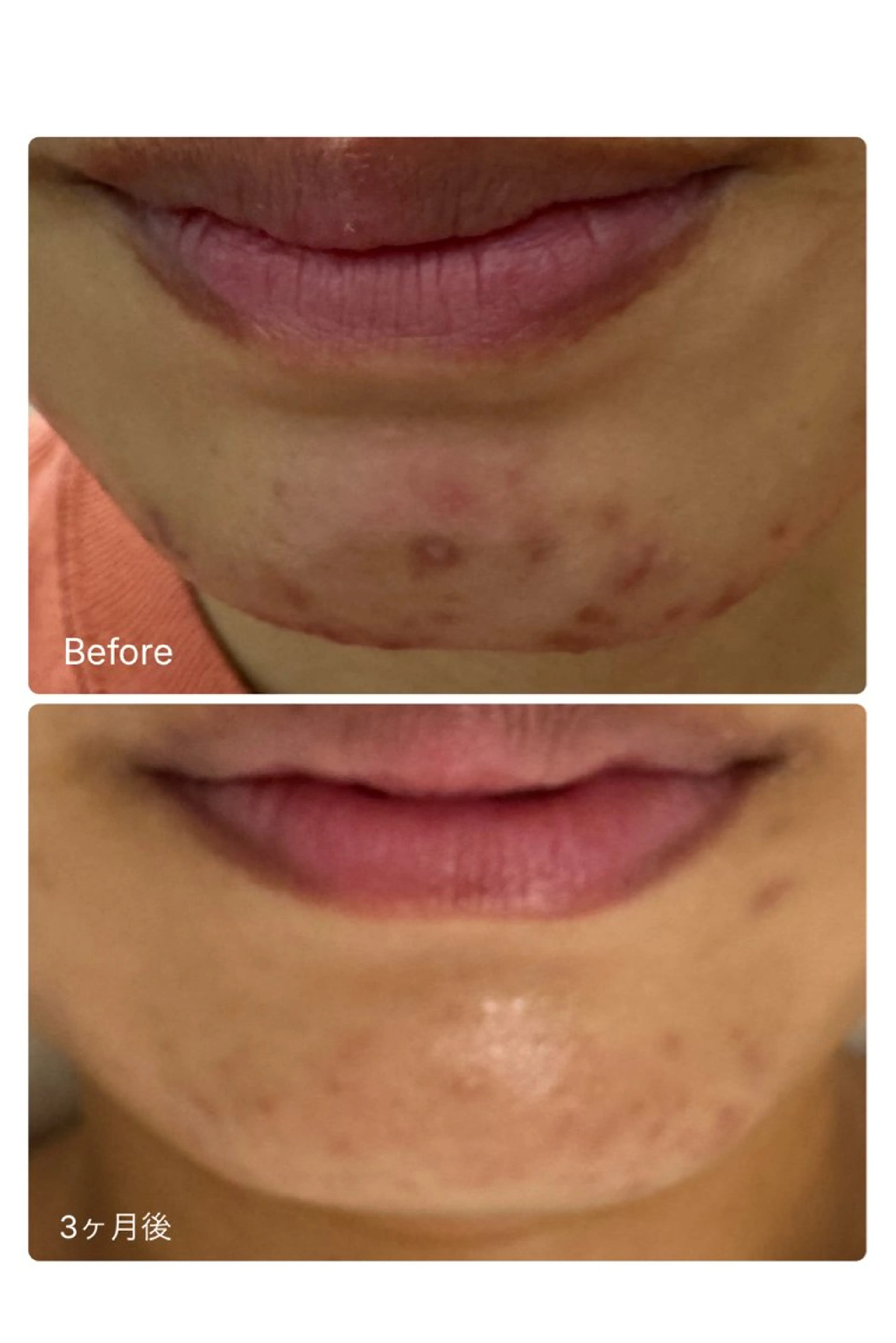 エステ 肌質改善/ツヤ肌作り /松本杏奈のエステ・リラクイメージ