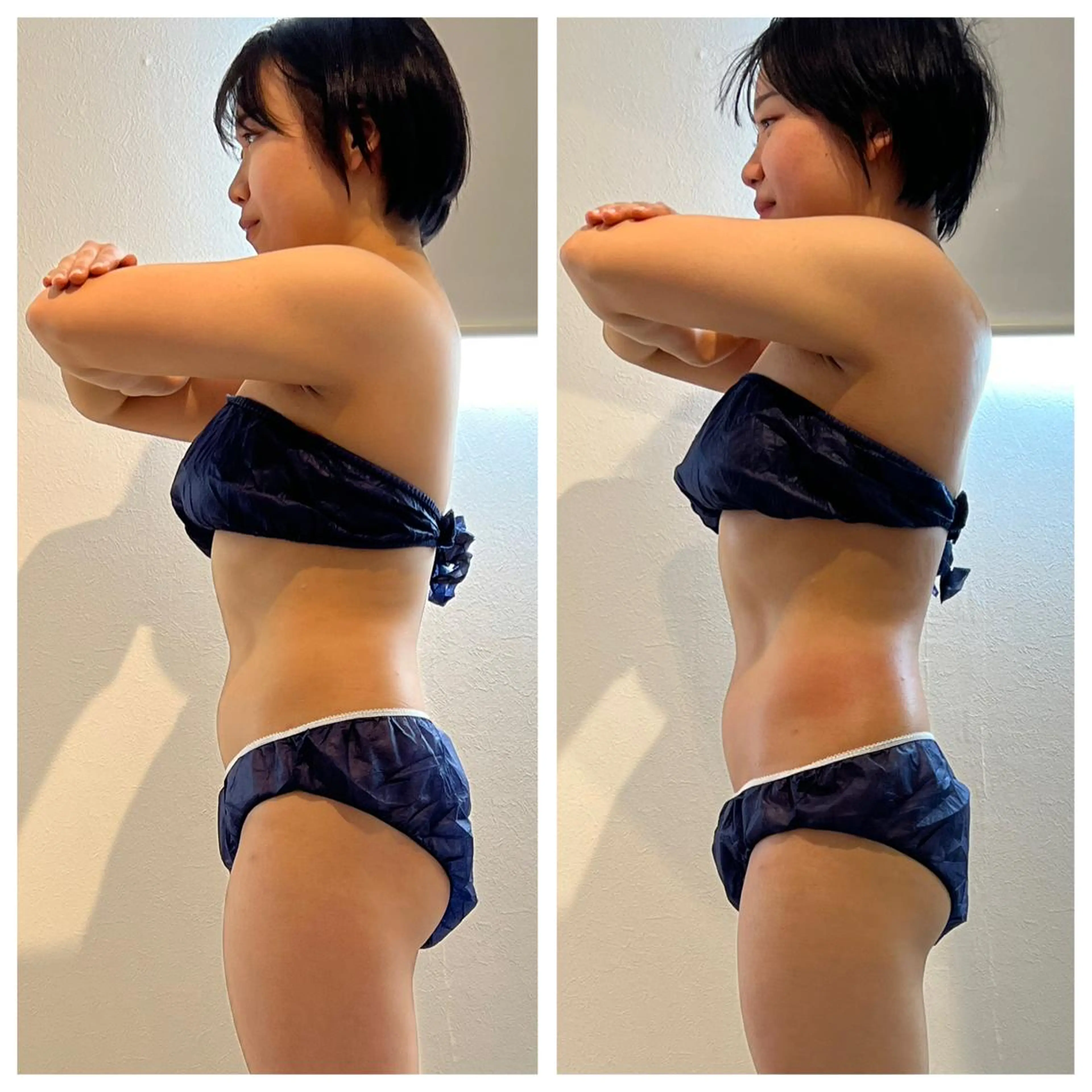 【まずは様子見したい方】ハイパーナイフ(半身)3回コース✨毎回上半身か下半身をお選び頂けます！の写真