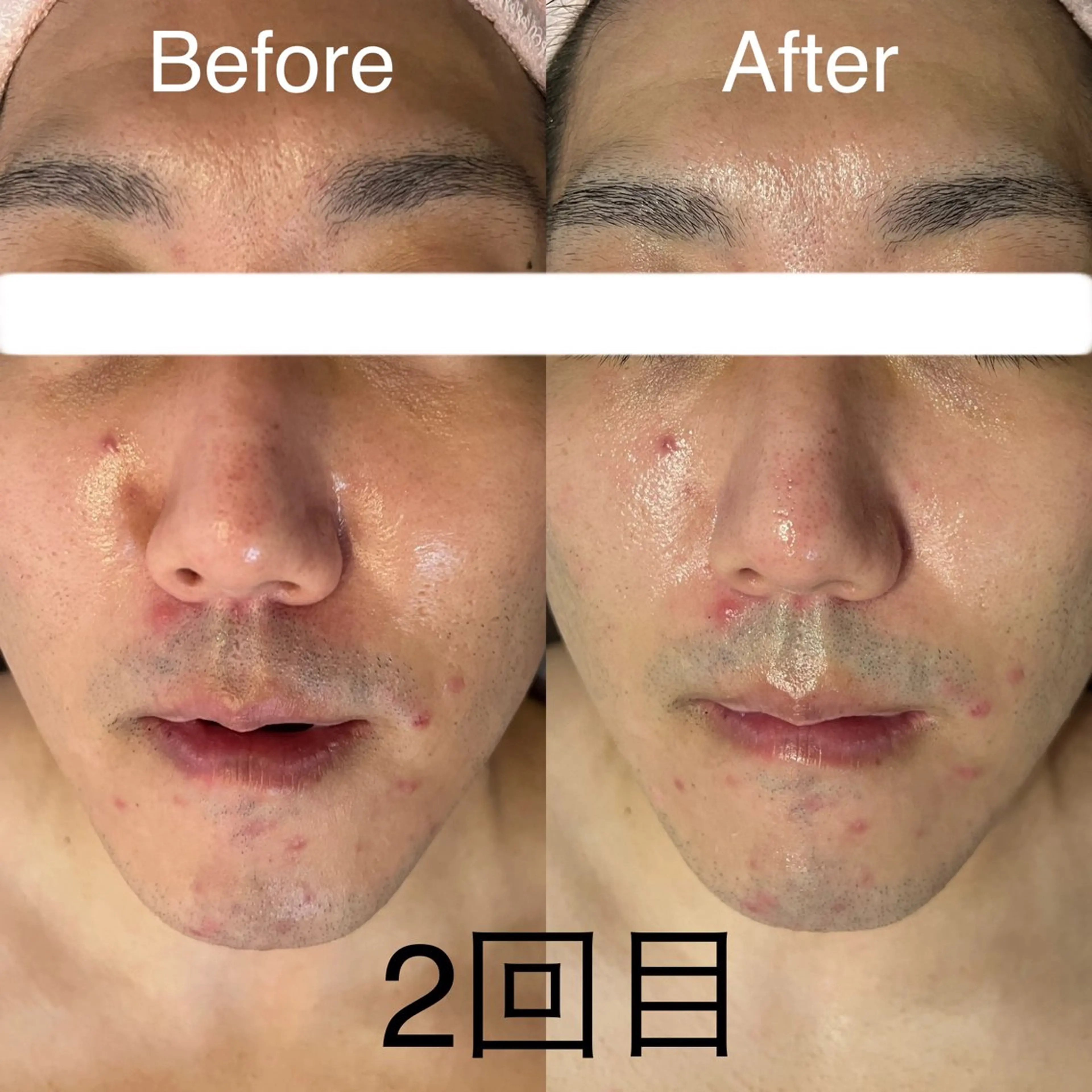 エステ Relaxation SalonARONAのエステ・リラクイメージ