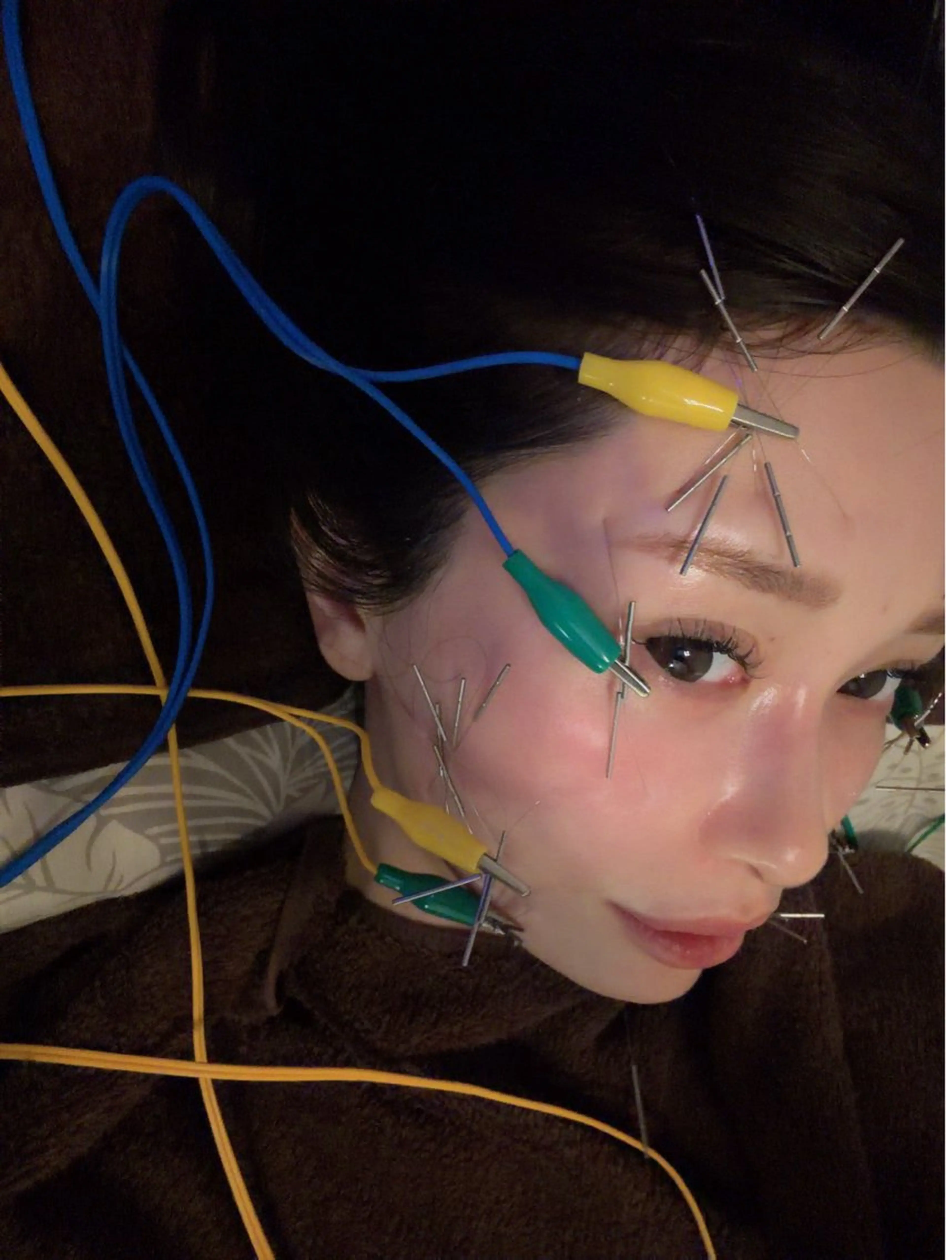 エステ 圧倒的たるみ改善 美容鍼エステのエステ・リラクイメージ