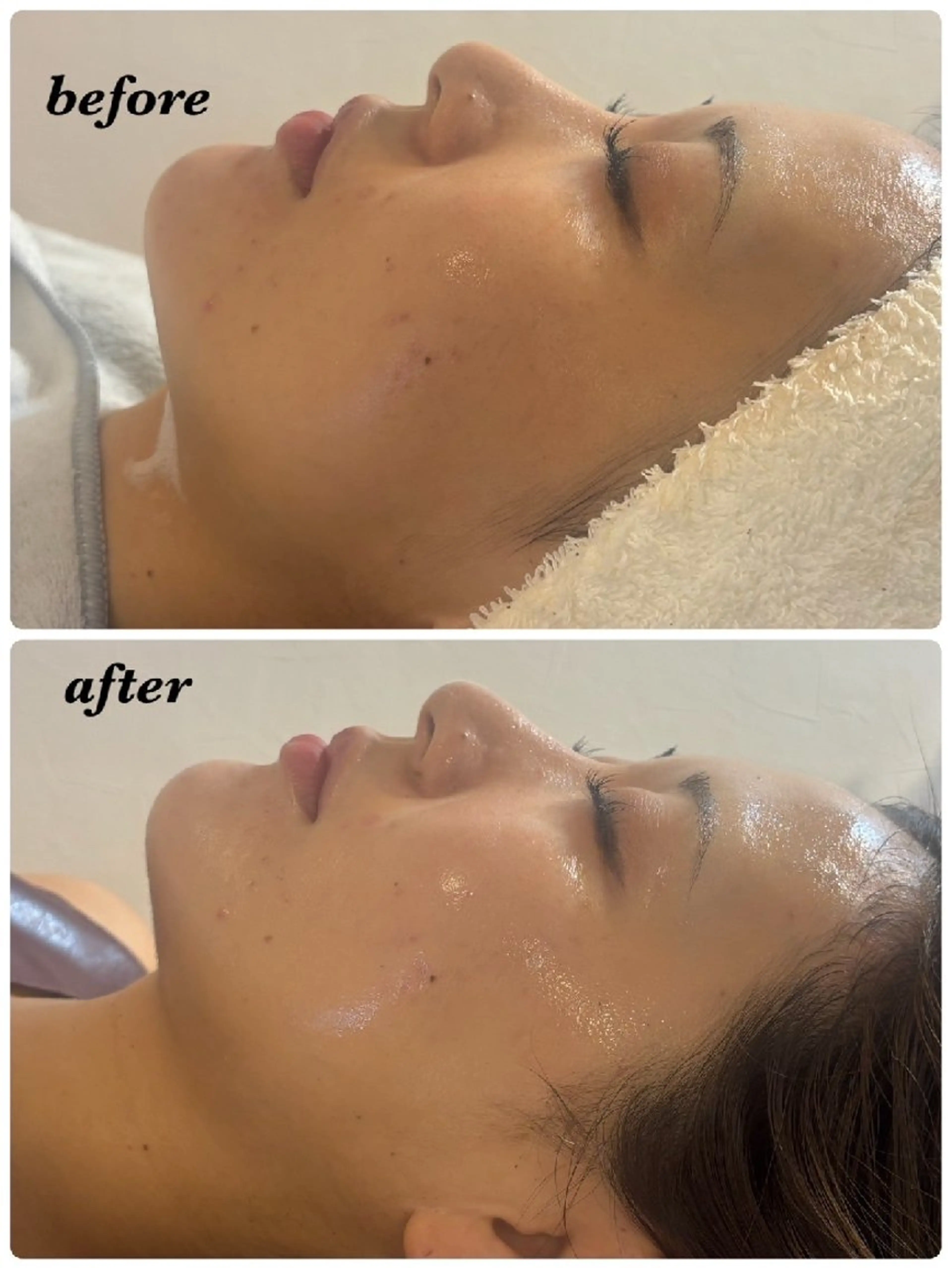 プライベートサロン✢ Eclatエクラ　のエステ・リラクイメージ