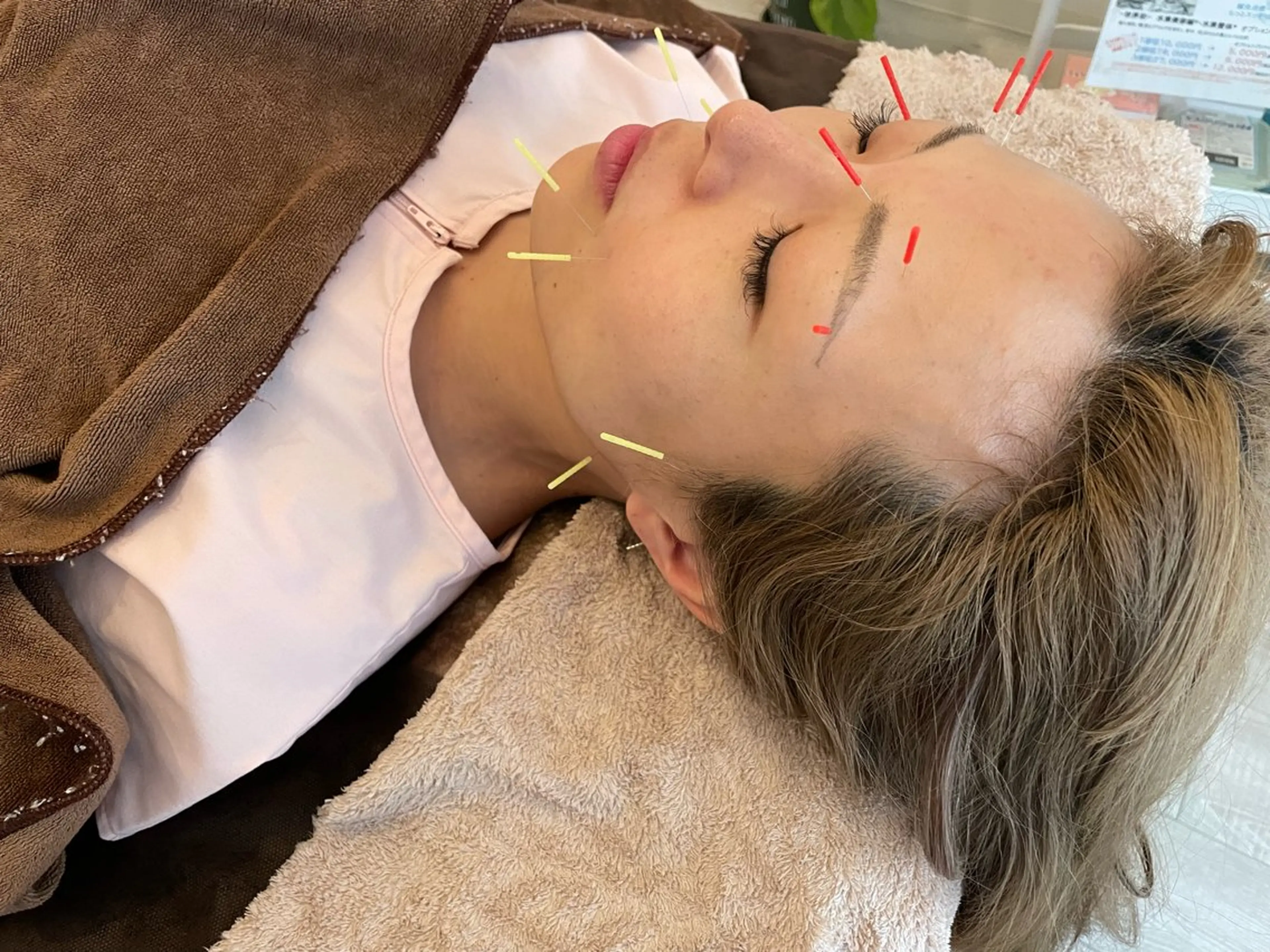 水島 秀輝（美容鍼灸師）のその他イメージ