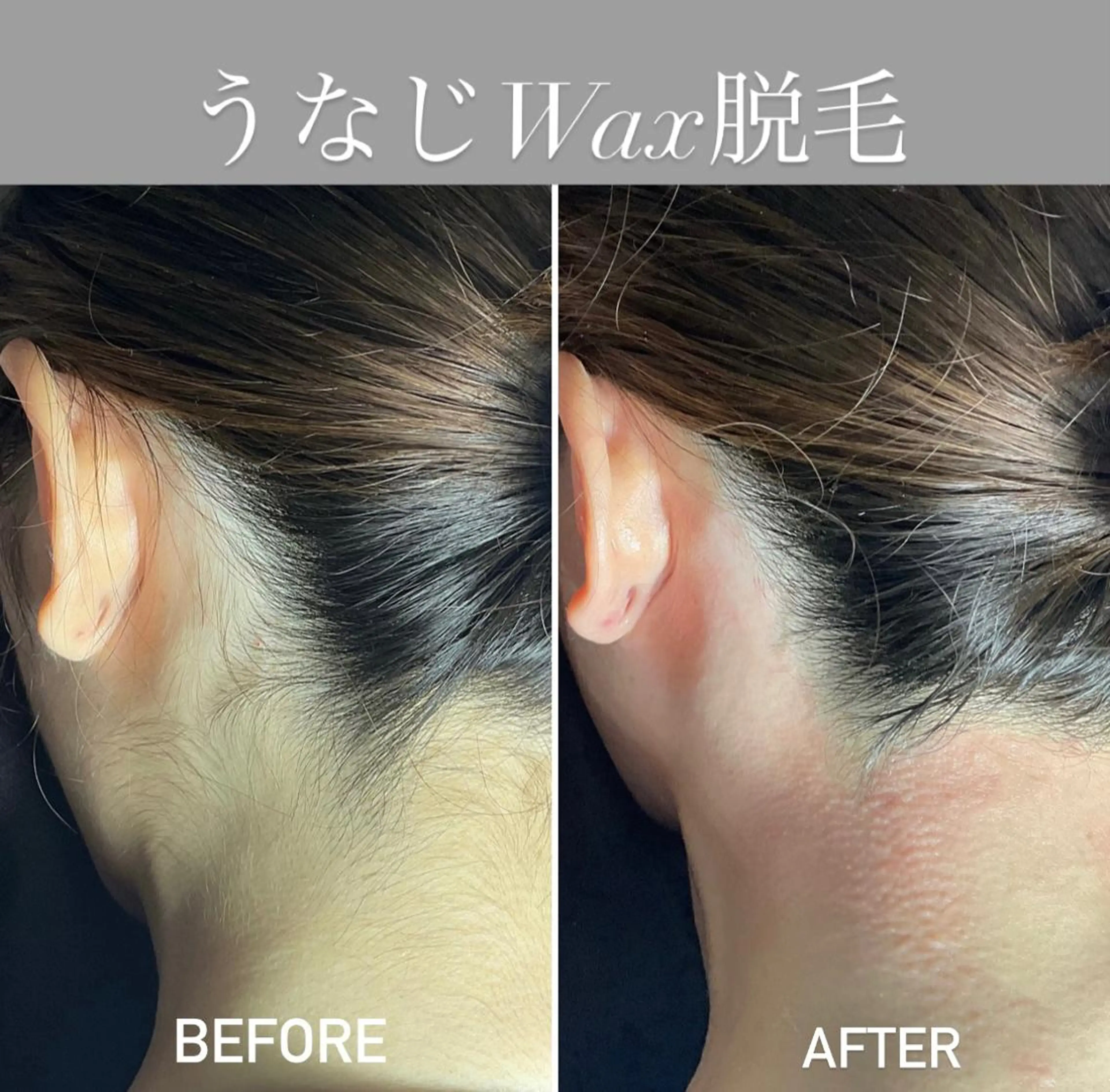 エピナス町田店 ブラジリアンワックスのエステ・リラクイメージ