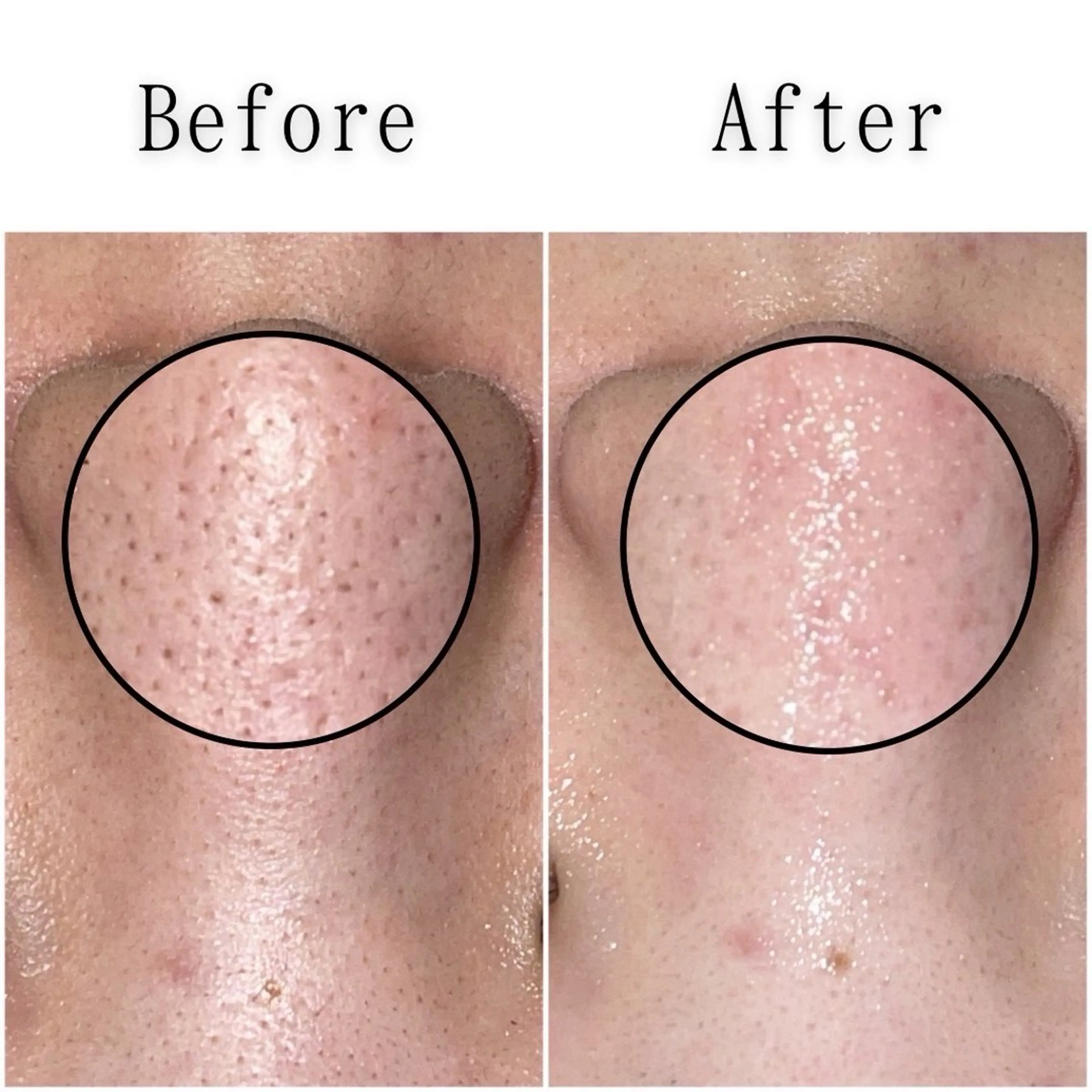 エステ シミ・毛穴専門店 /gracia 安藤のエステ・リラクイメージ