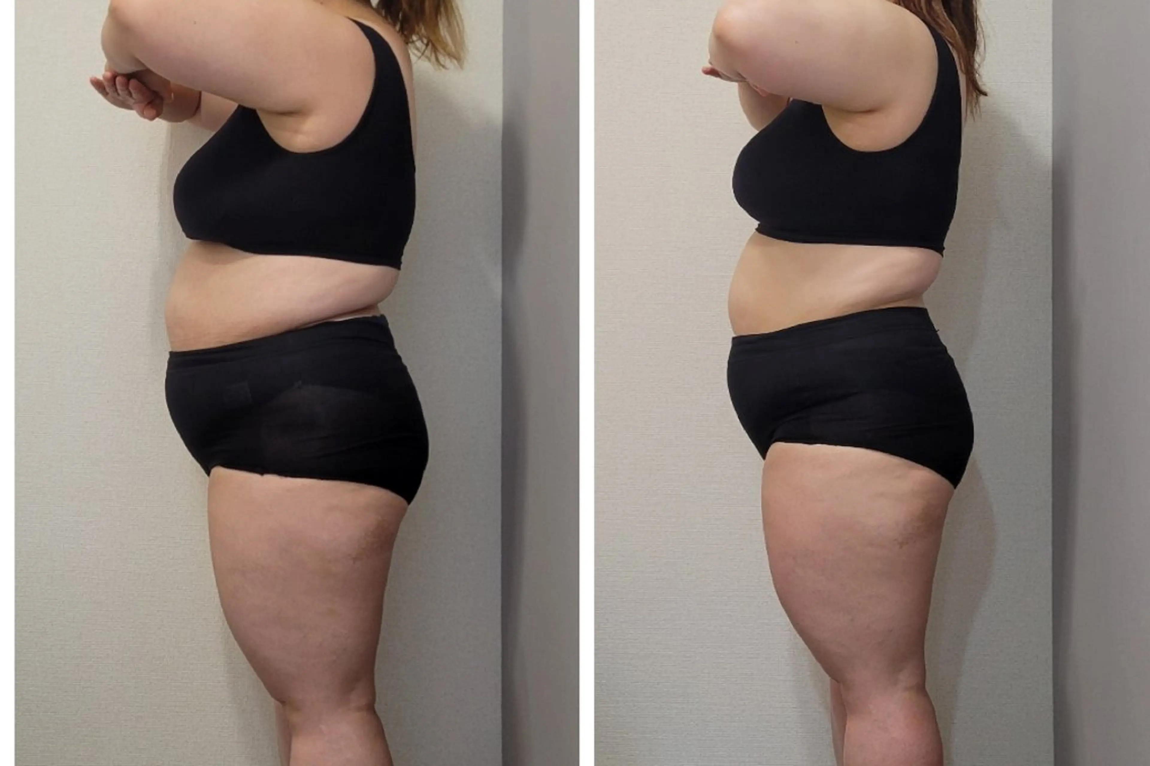 エステ リラク ダイエット/体質改善 /筋膜リリース専門店のエステ・リラクイメージ