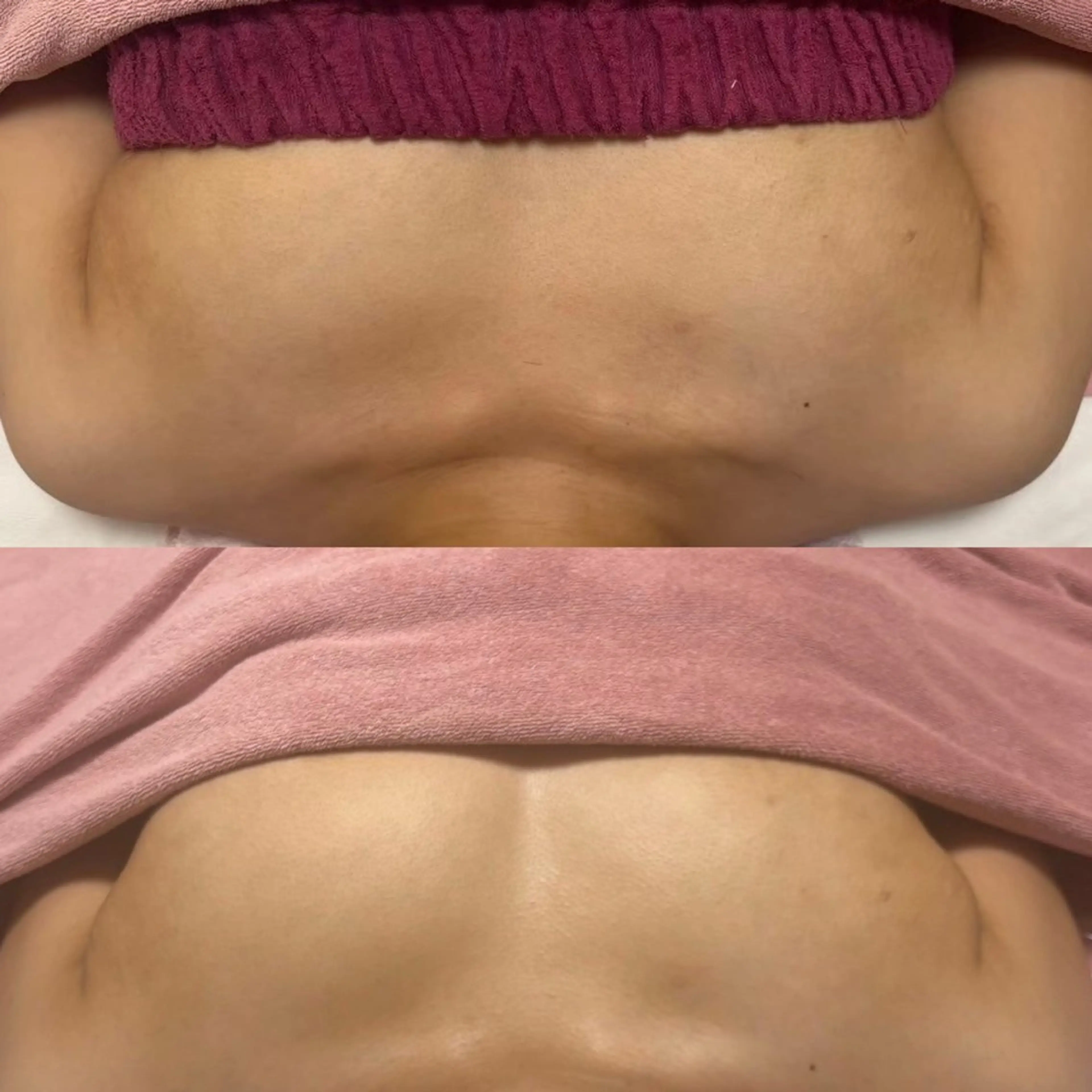 冷え×巡り改善！バスト✕鉄✕ビタミンBRの写真