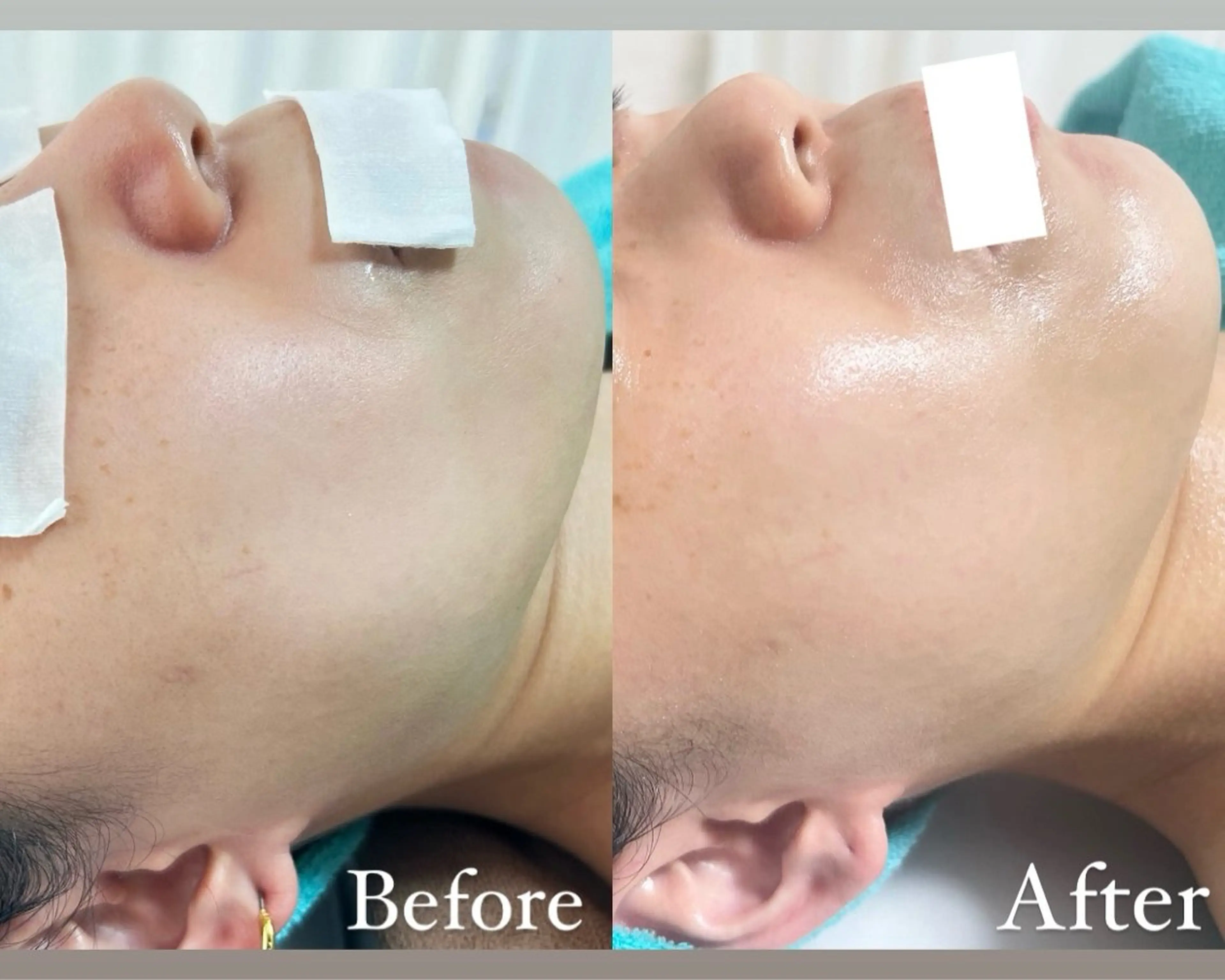 エステ Be Charm 山﨑のエステ・リラクイメージ