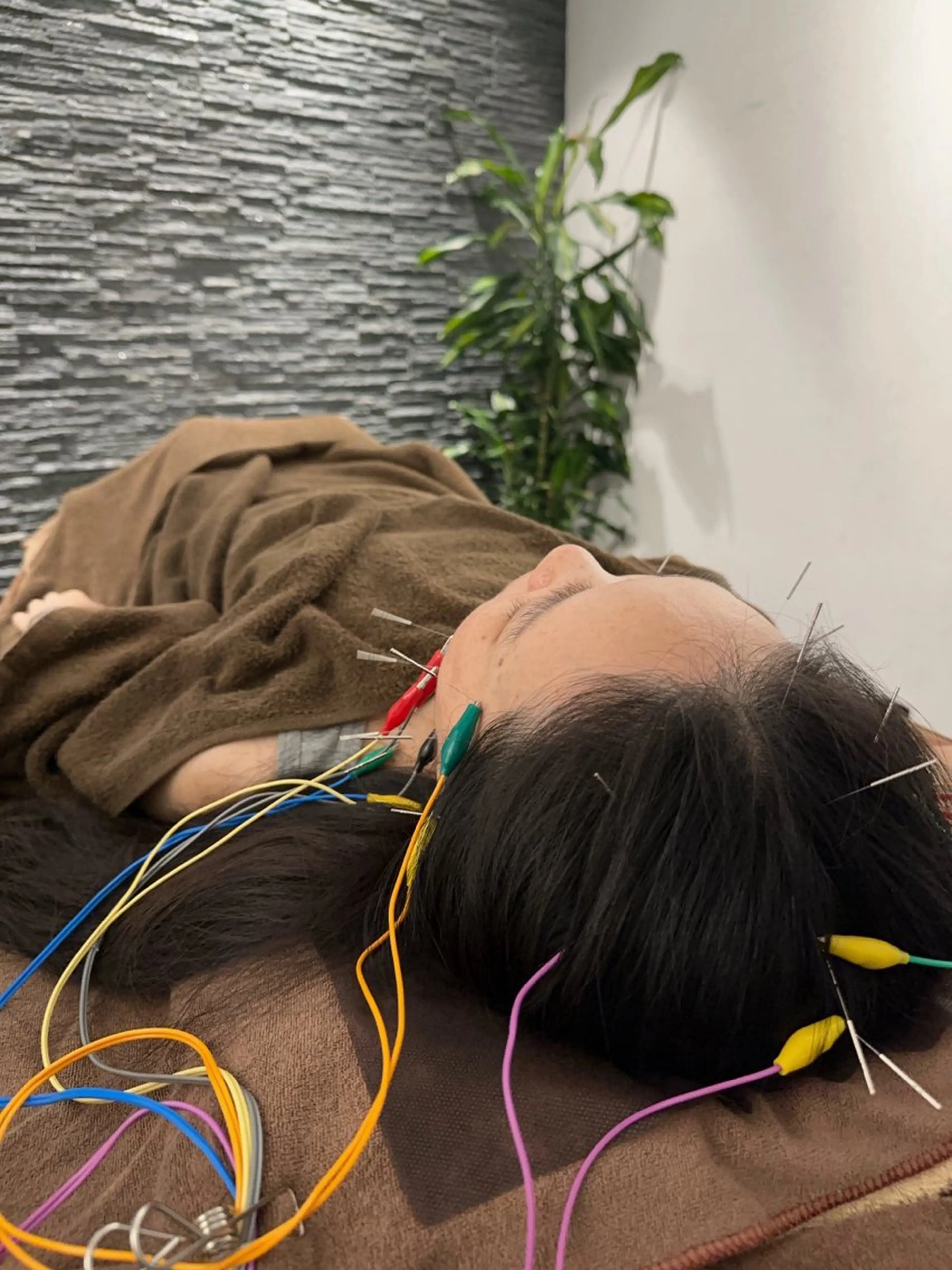 その他 小顔矯/美容鍼/鍼灸 BeauJuのその他イメージ