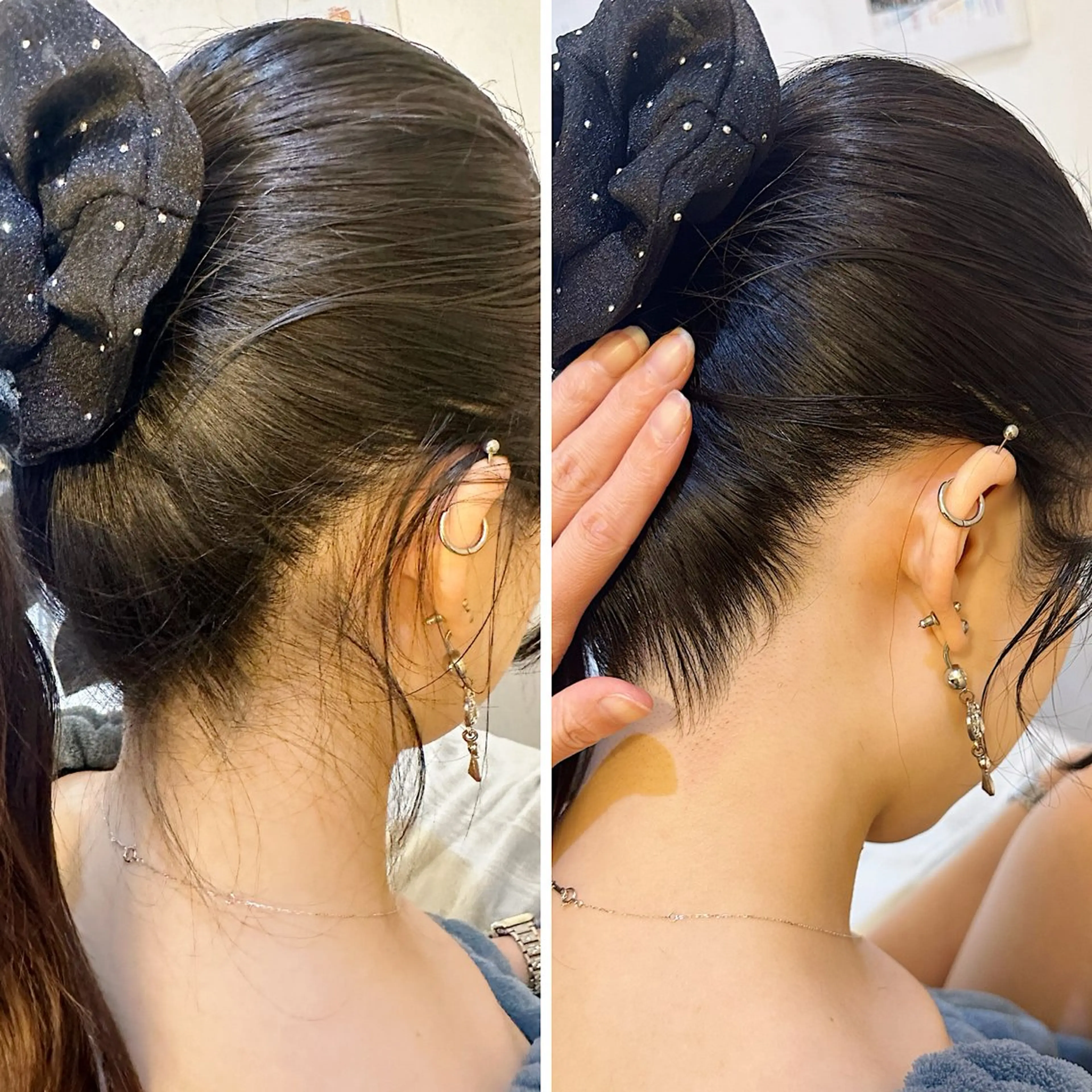 脱毛 うなじ脱毛/美肌脱毛 LABELのエステ・リラクイメージ