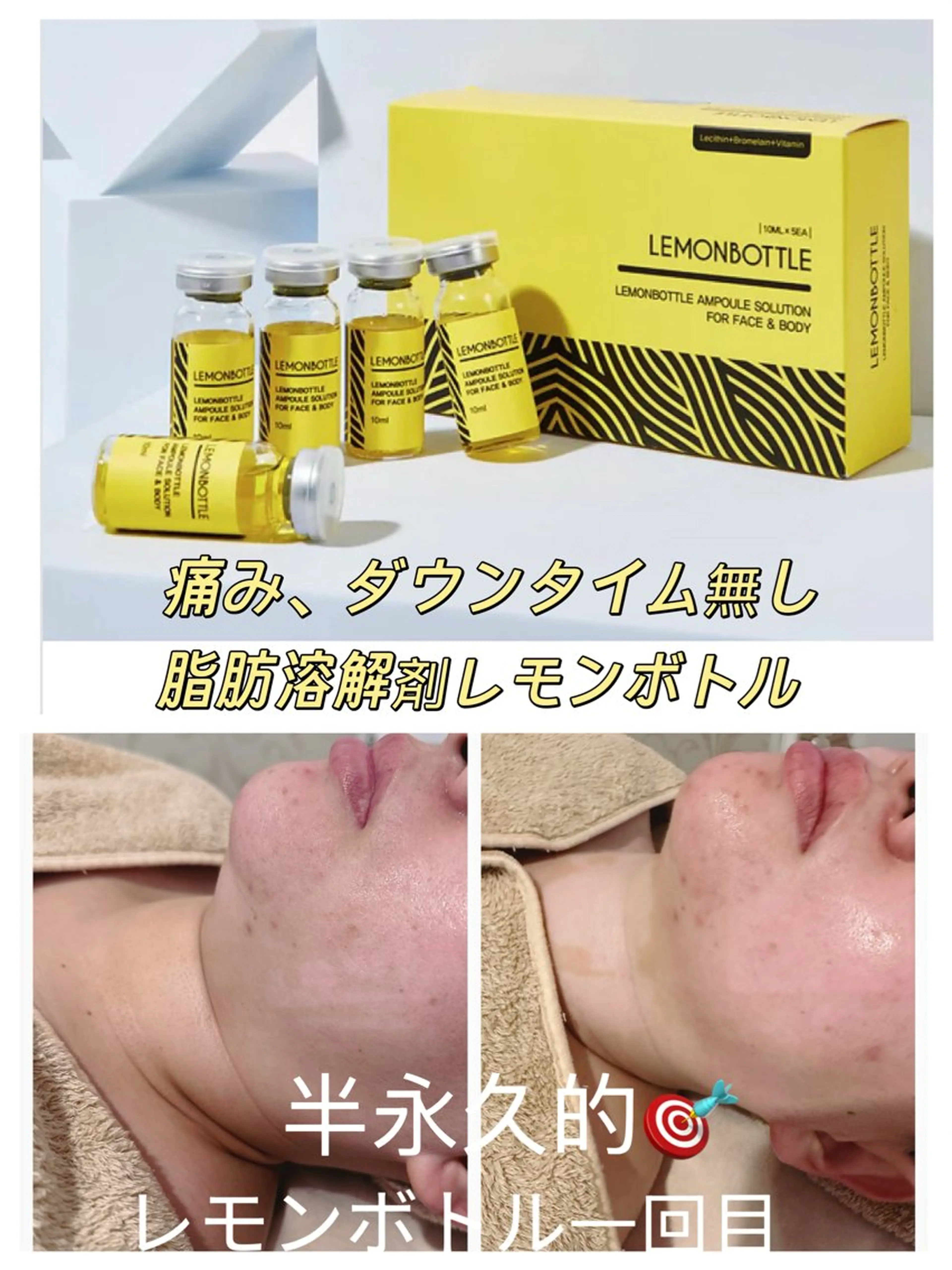 1人1回体験♪韓国発&脂肪＆溶解【レモン】コルギ+2CC導入/二重顎/たるみの写真