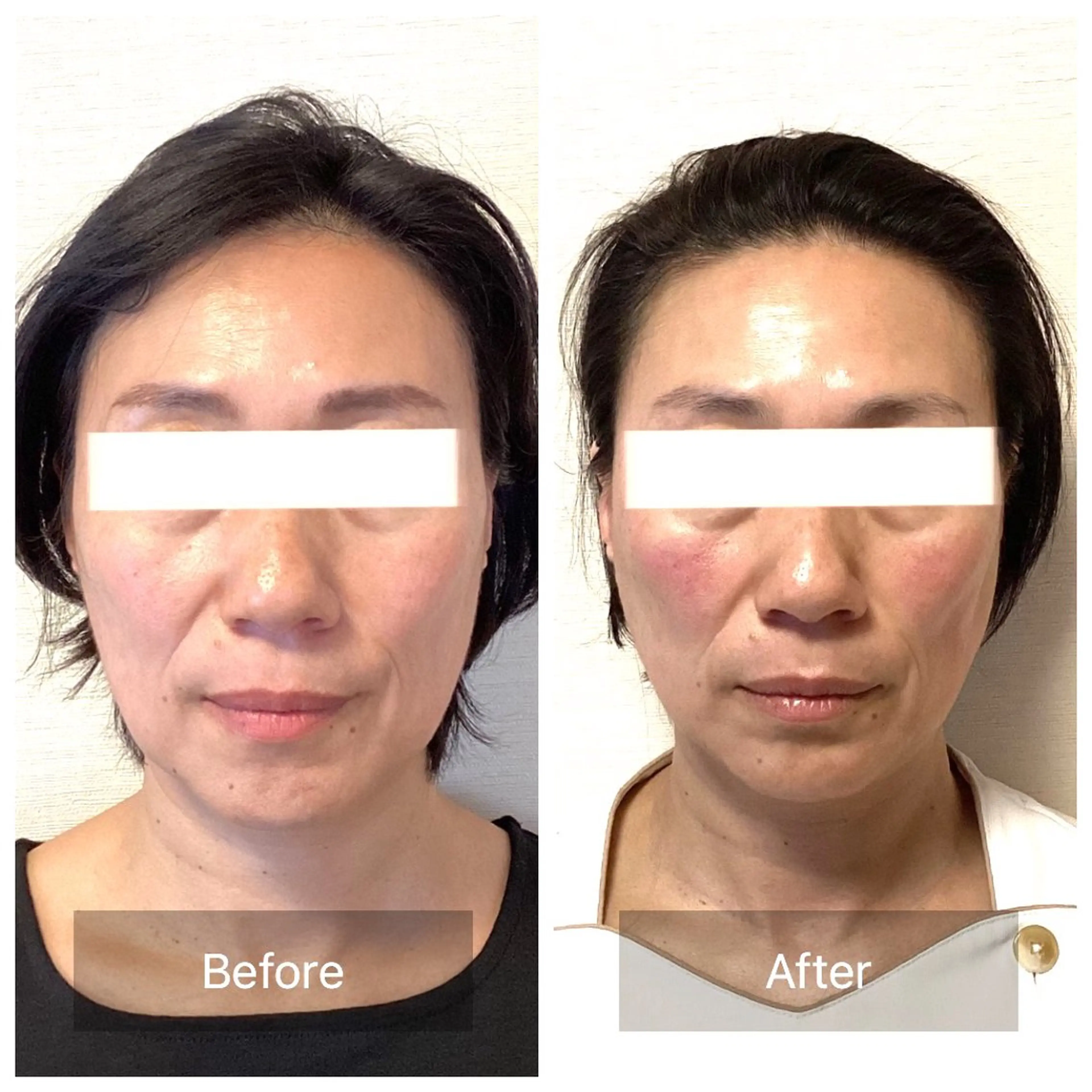 小顔・歪み専門　井元 朋子のエステ・リラクイメージ