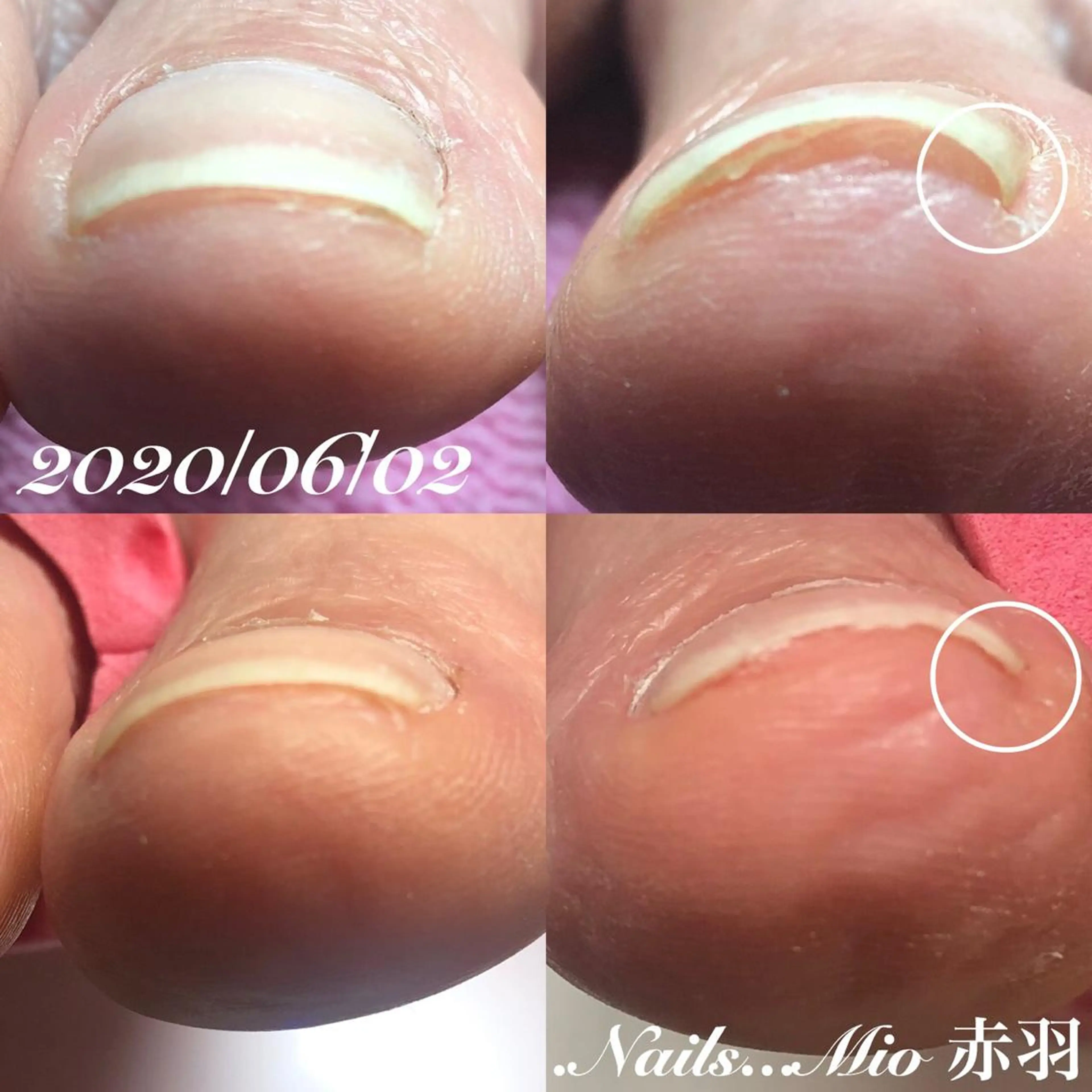 ネイル フットネイル .Nails Mio 赤羽西ネイルサロンのネイルデザイン