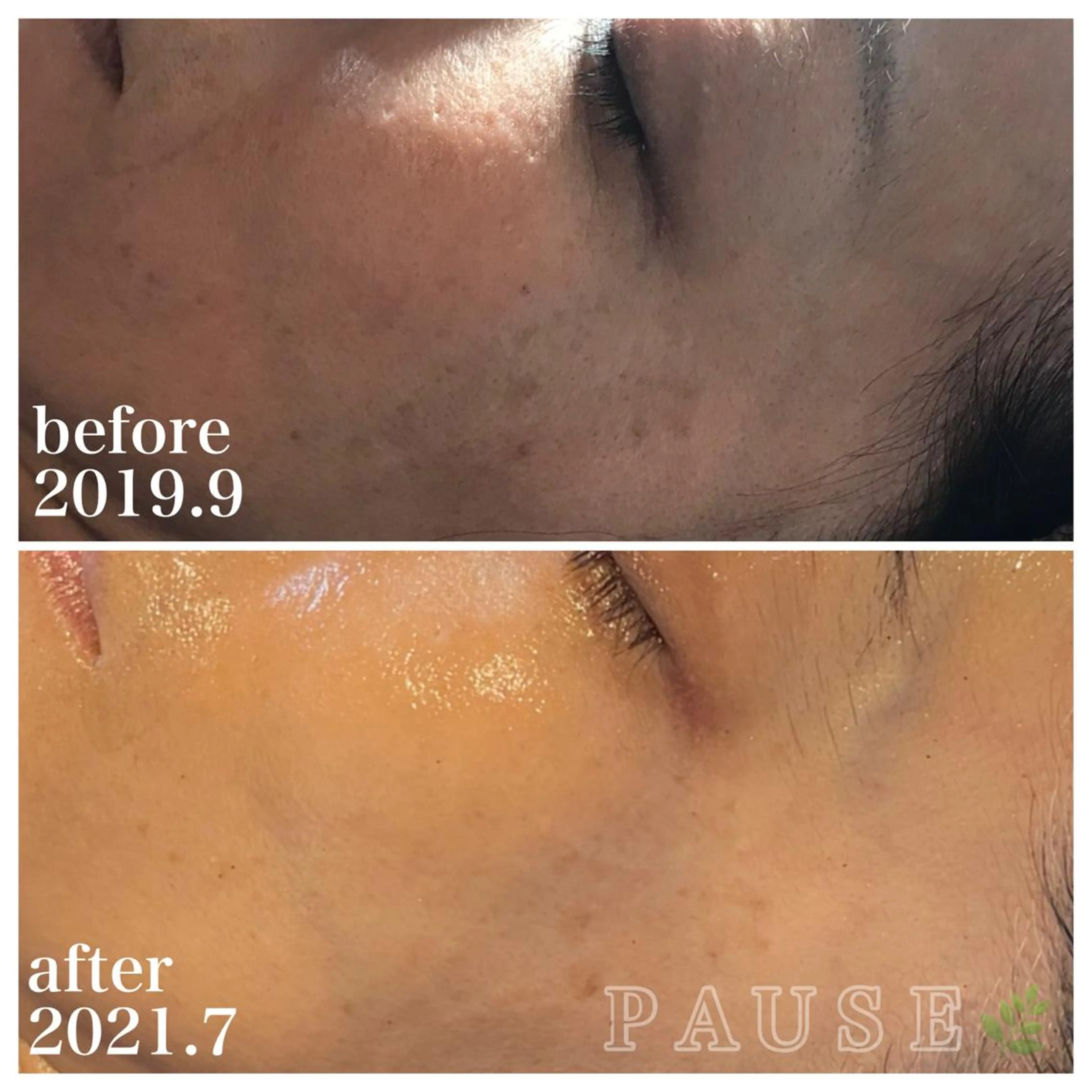 エステ 浜野 恵美のエステ・リラクイメージ