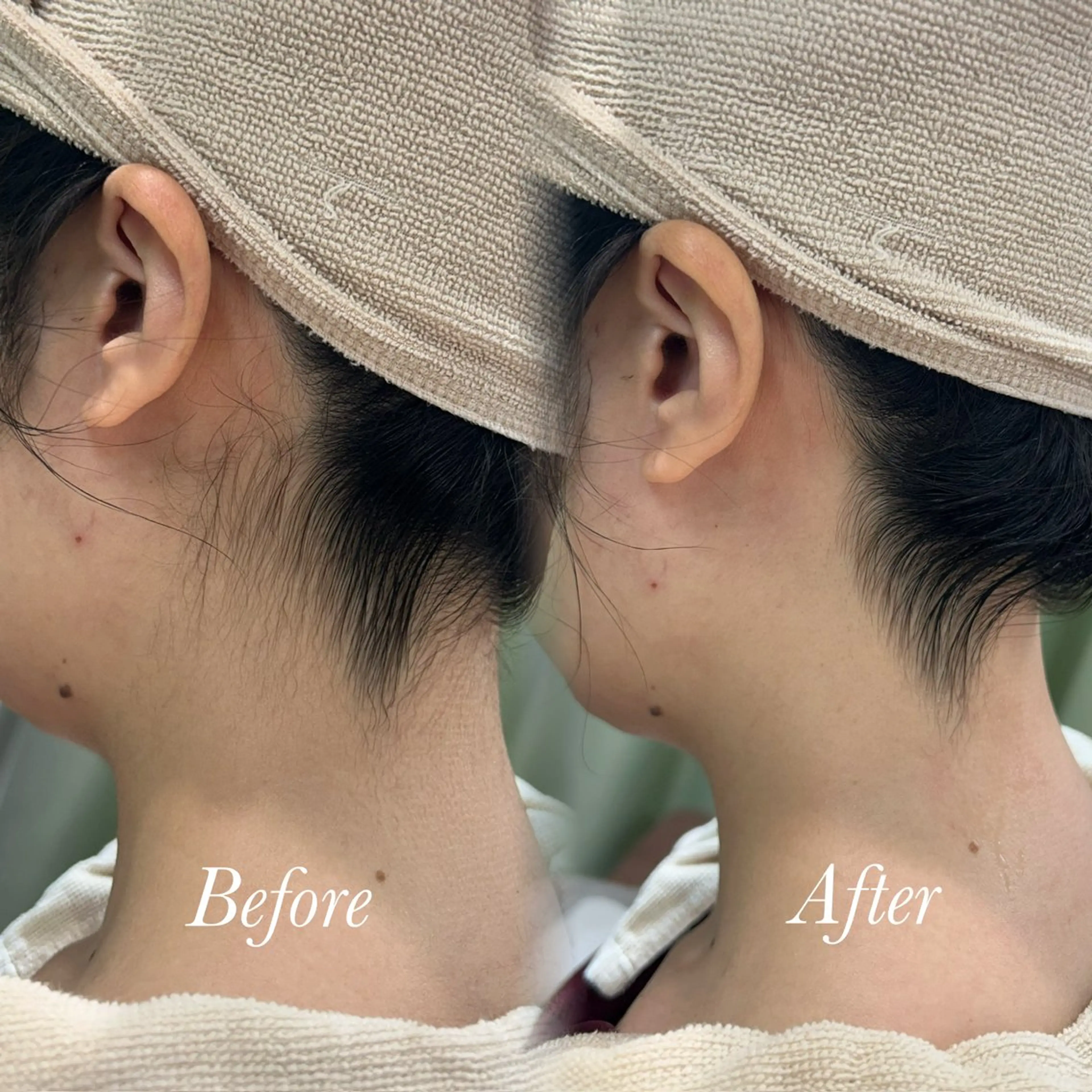 その他 🫧美しい素肌へ🫧 今成柚乃のその他イメージ