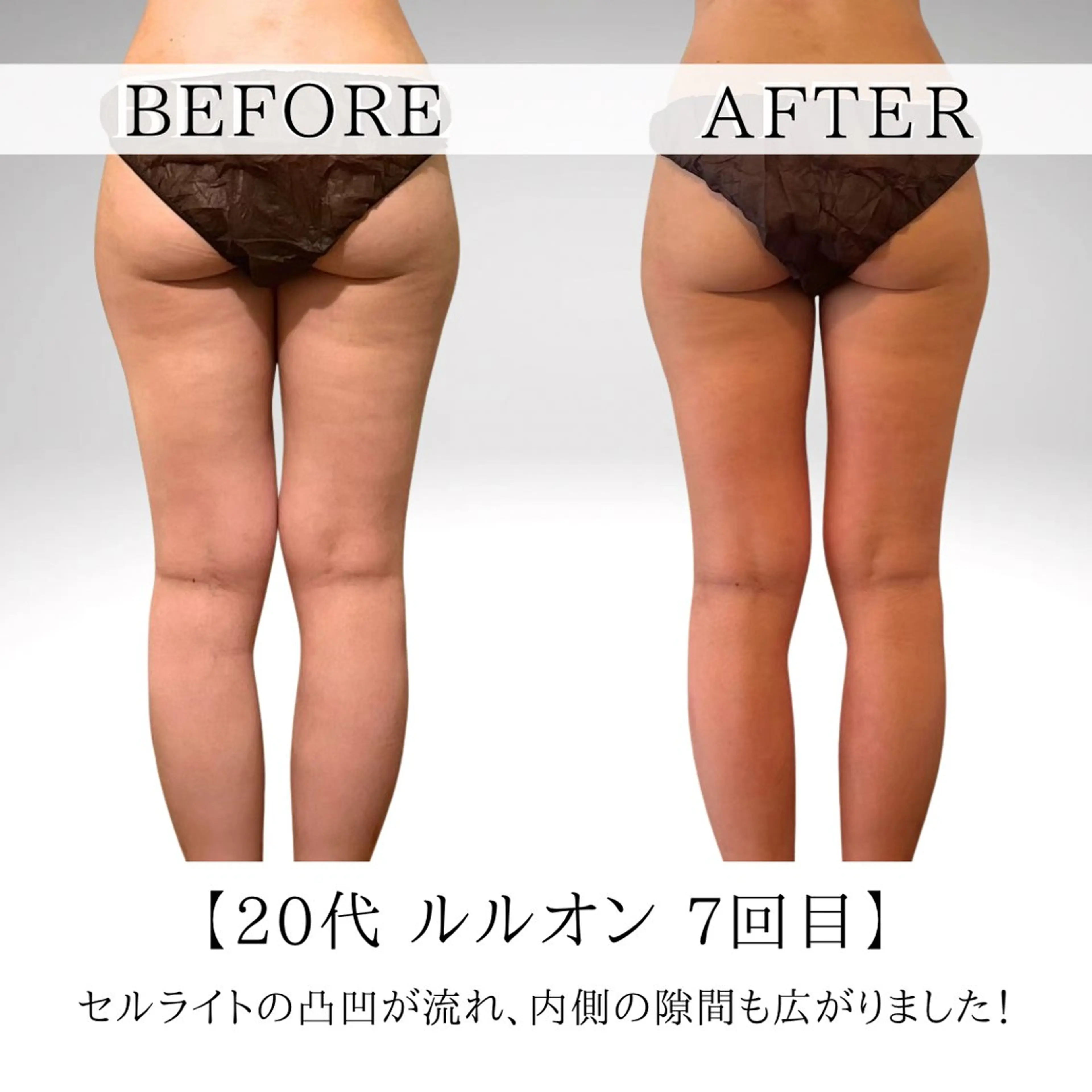 エステ リラク あみ|痩身の最先端 よもぎ蒸しサロン大塚のエステ・リラクイメージ