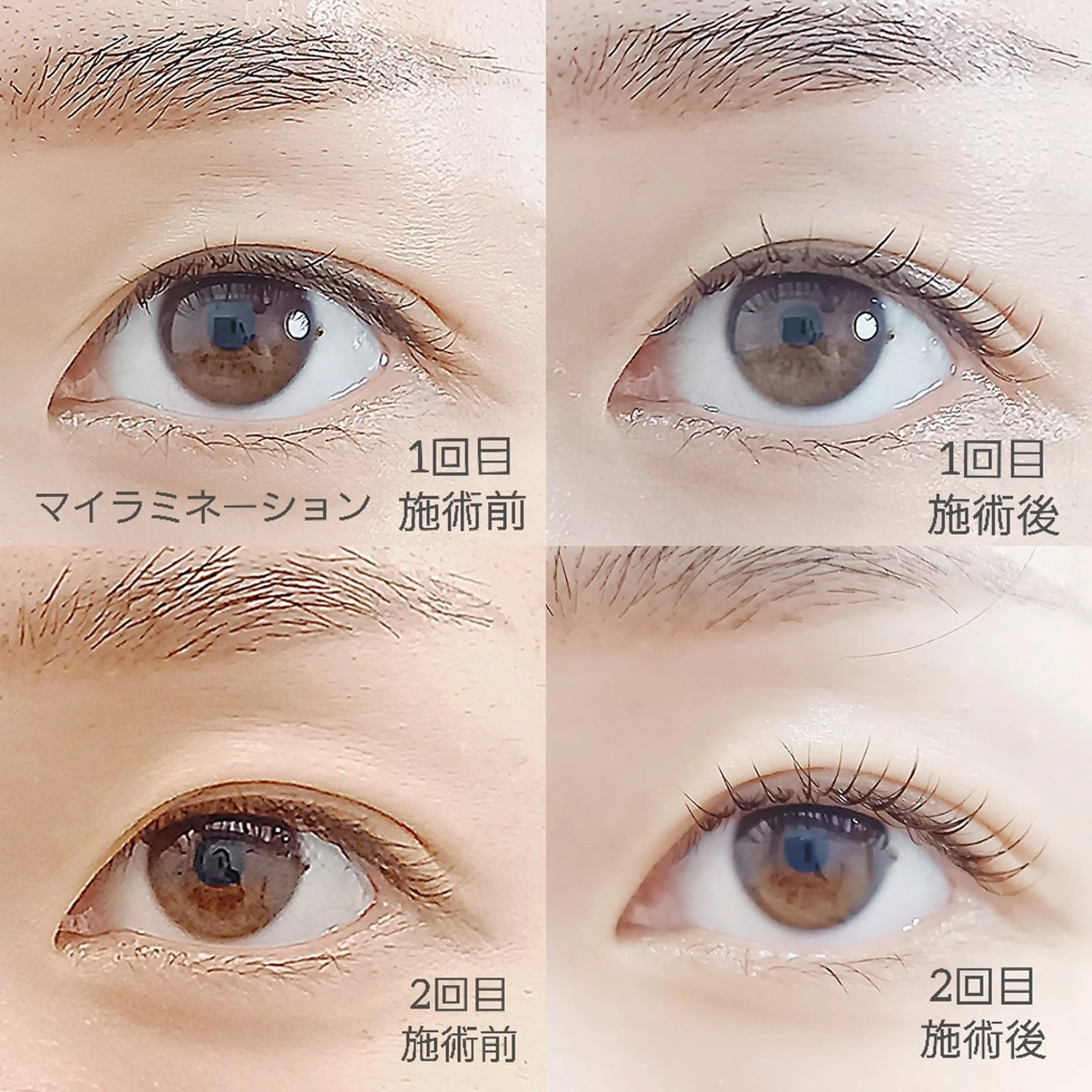 マツエク・マツパ 一重×まつ毛パーマ マツパ  MIKU .のマツエク・マツパデザイン