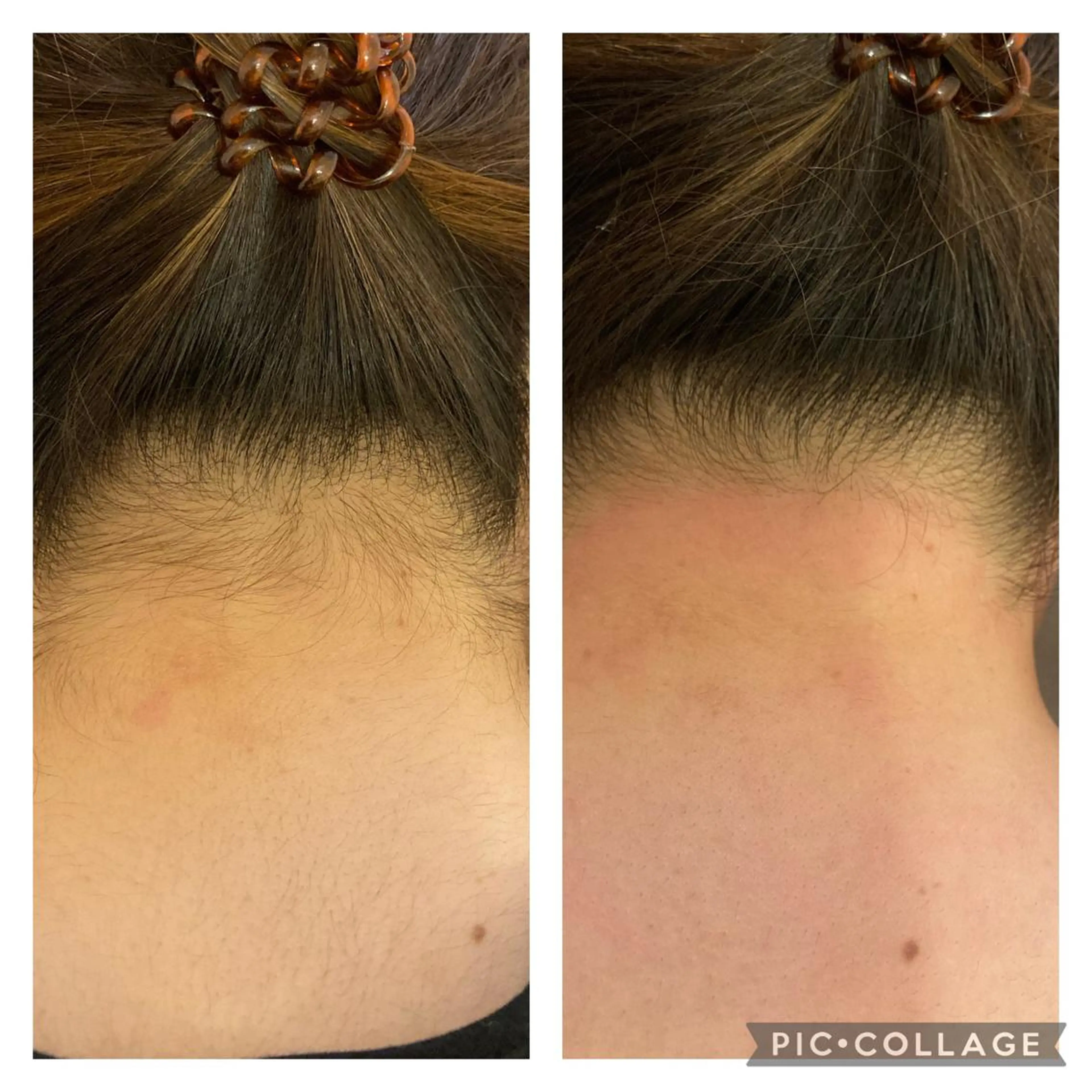 MARI シュガーリストのエステ・リラクイメージ