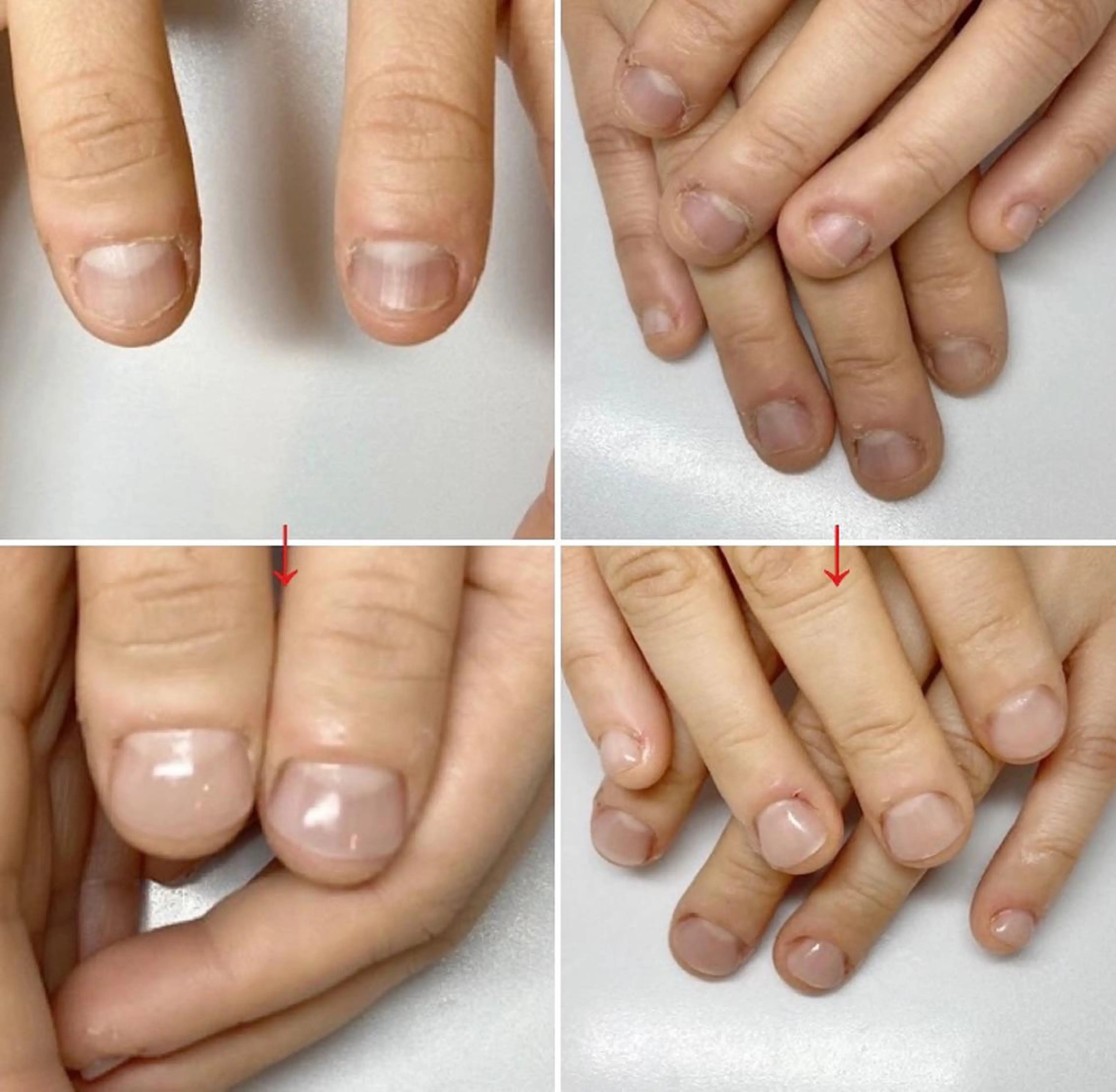 ネイル フットネイル ネイルサロン アリュームのネイルデザイン