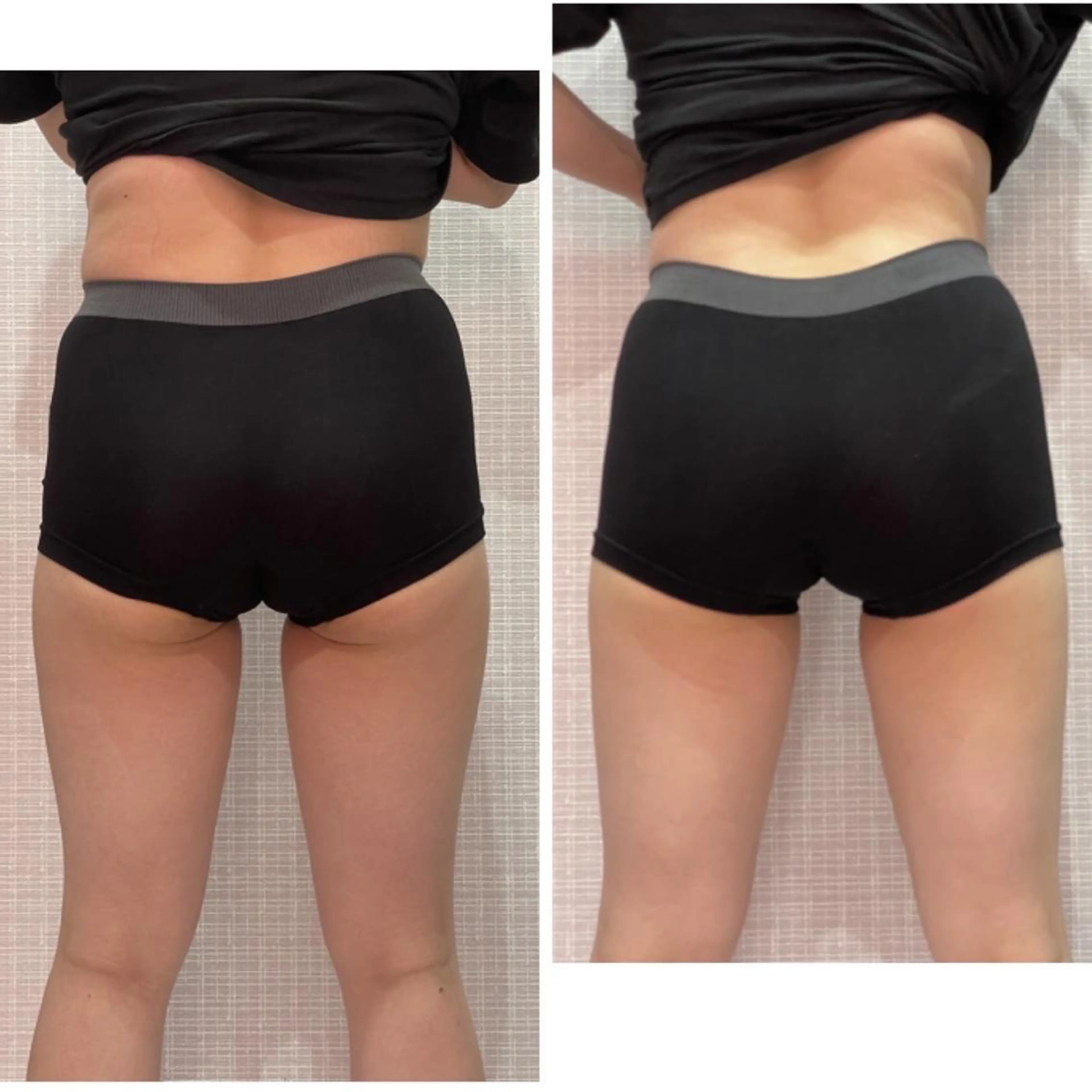 定額制セルフエステ my　salonのエステ・リラクイメージ