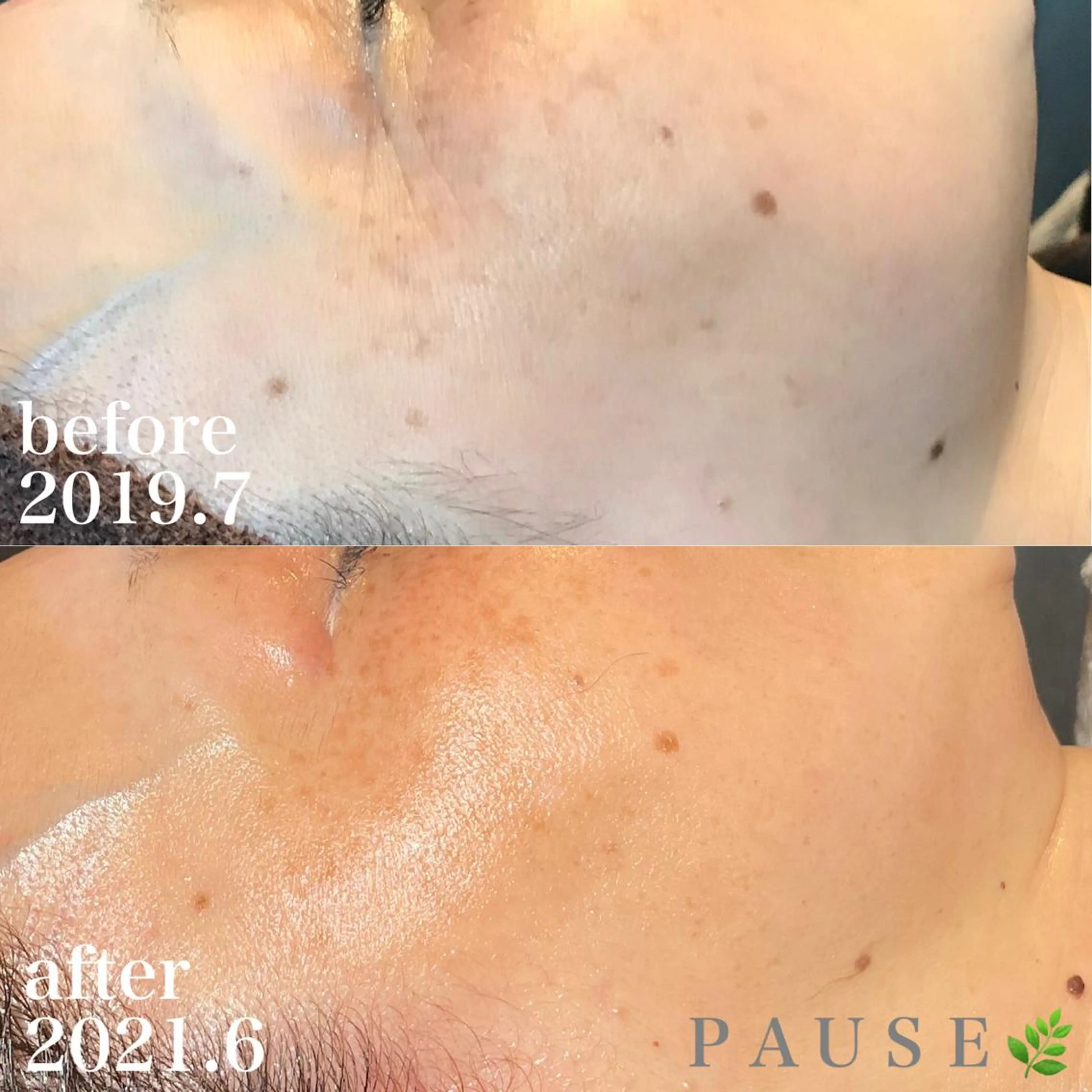 エステ 浜野 恵美のエステ・リラクイメージ